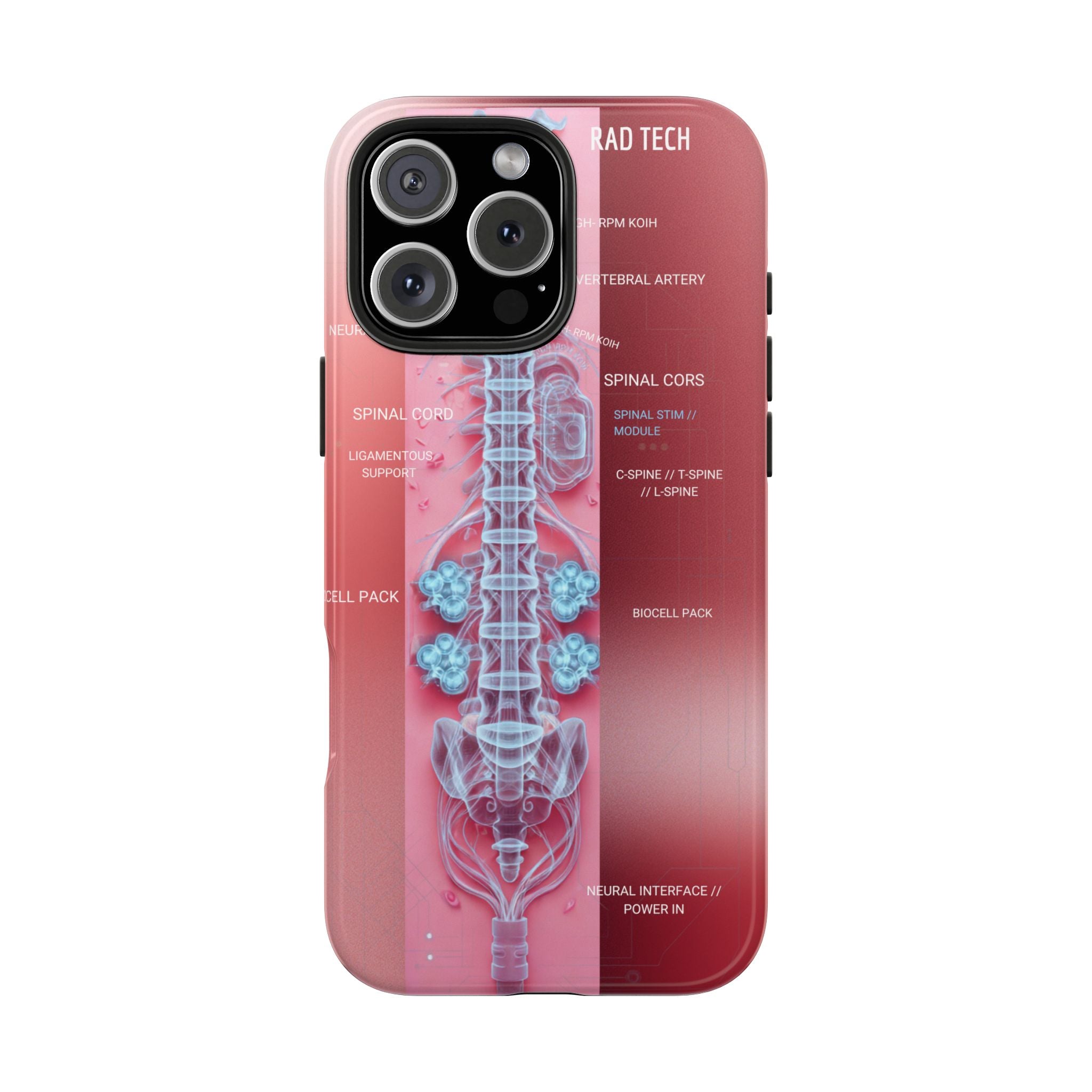 Anatomical Spine Tough Phone Case — Medical X-Ray Design, ‘Spinal Cord’ Labelled