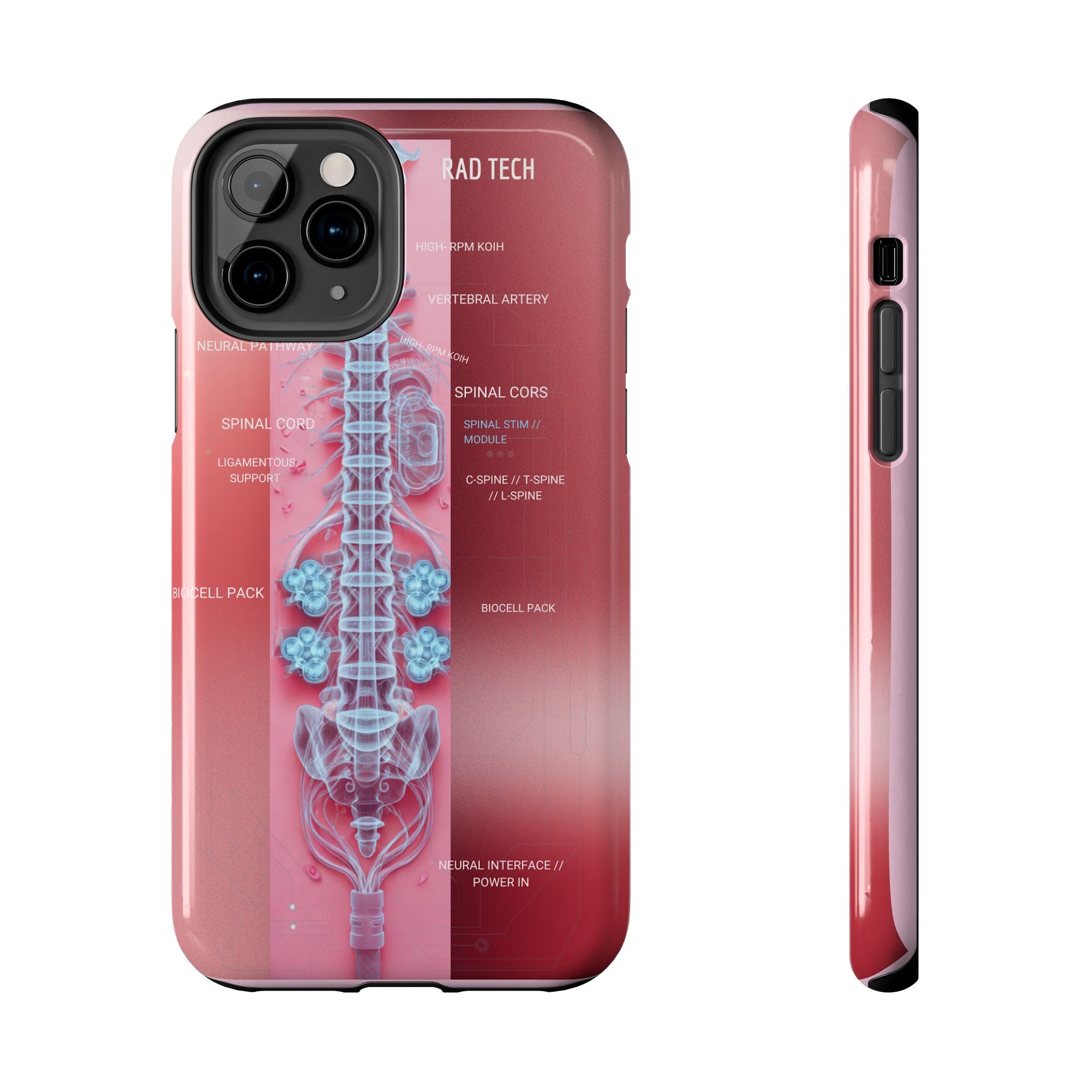 Anatomical Spine Tough Phone Case — Medical X-Ray Design, ‘Spinal Cord’ Labelled