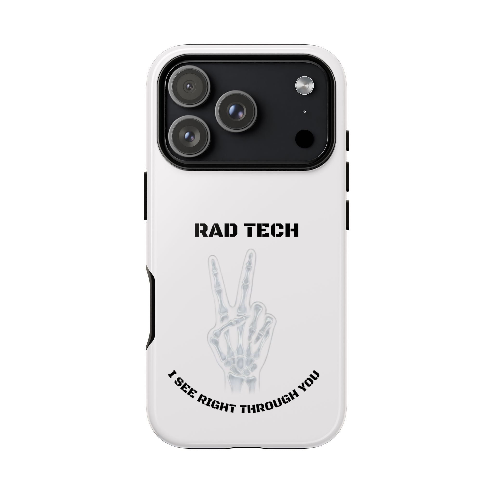 Rad Tech Phone Case — Skeleton Hand "I See Right Through You" X-ray Technician Gift