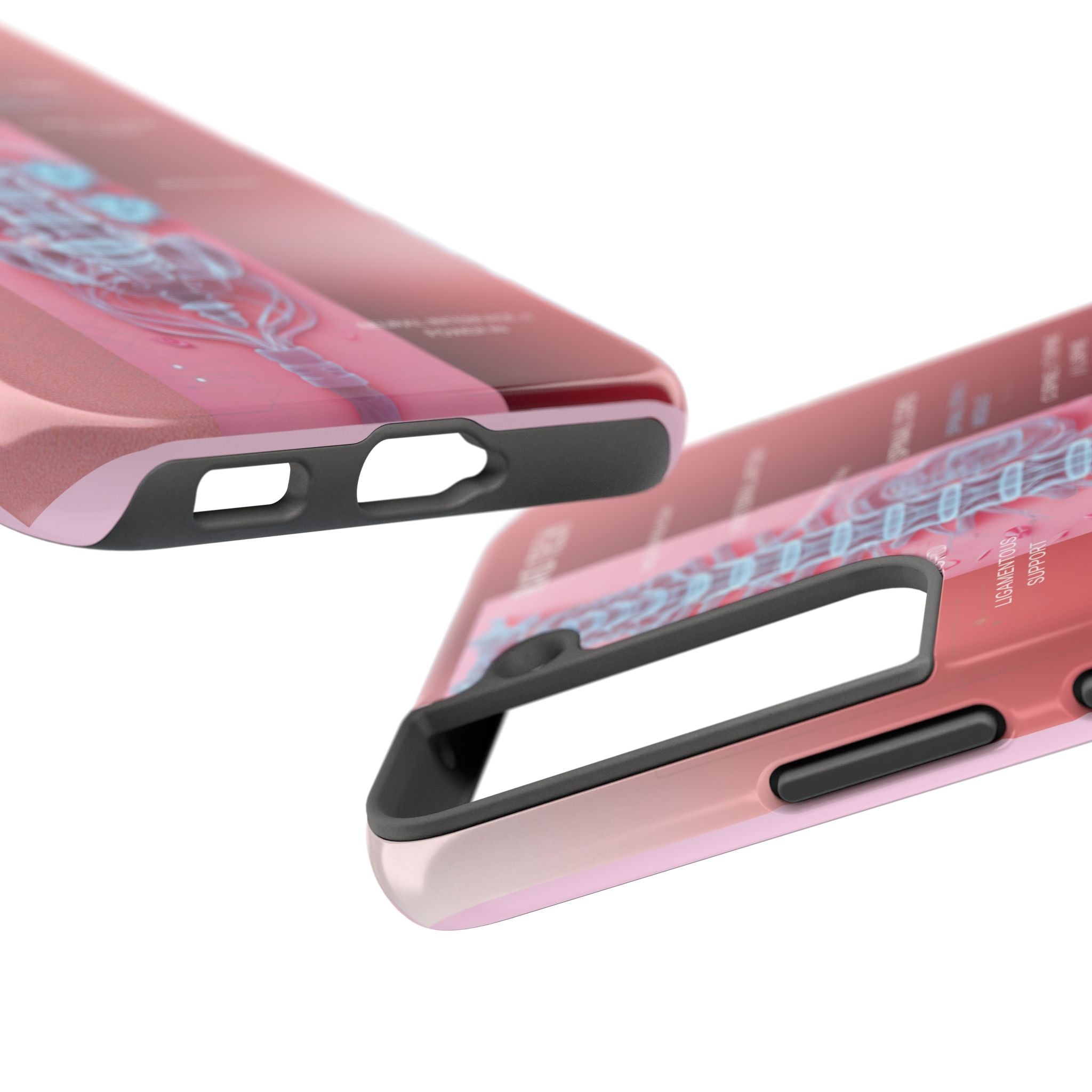 Anatomical Spine Tough Phone Case — Medical X-Ray Design, ‘Spinal Cord’ Labelled