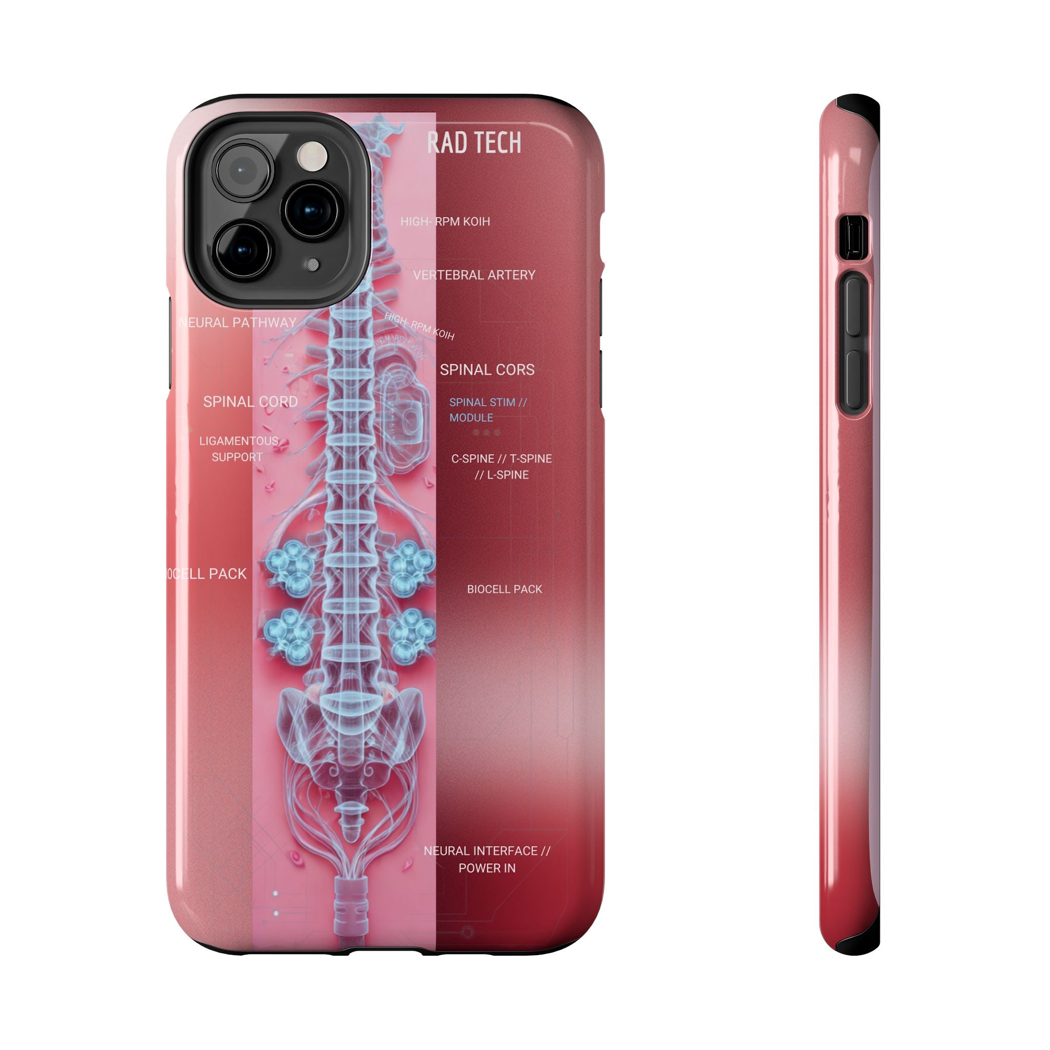 Anatomical Spine Tough Phone Case — Medical X-Ray Design, ‘Spinal Cord’ Labelled