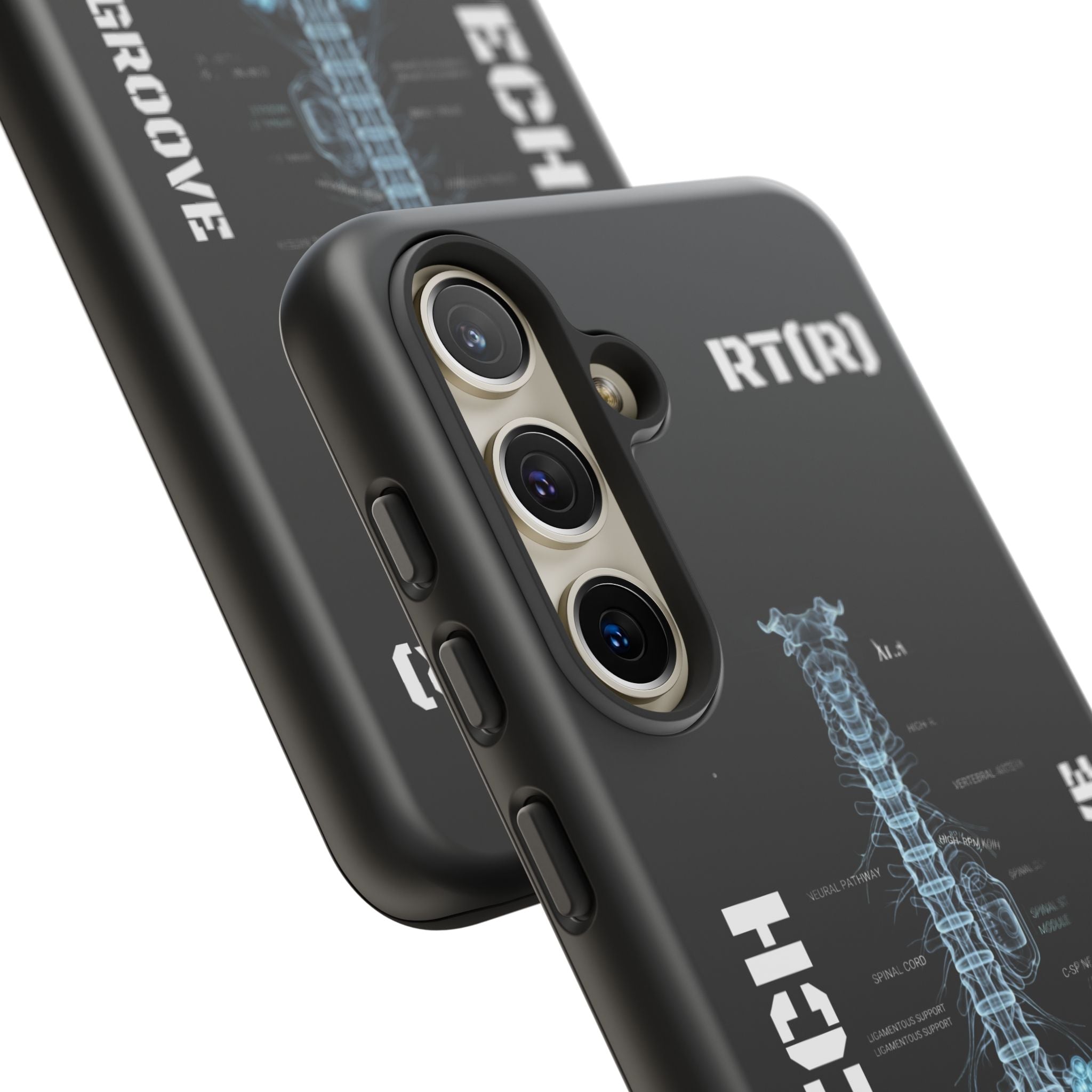 RAD TECH -Aesthetic Phone Case