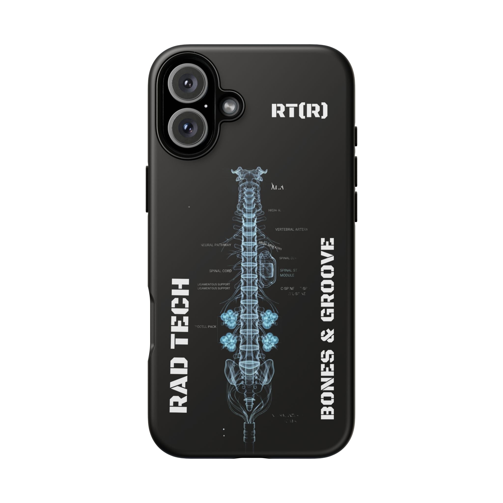 RAD TECH -Aesthetic Phone Case