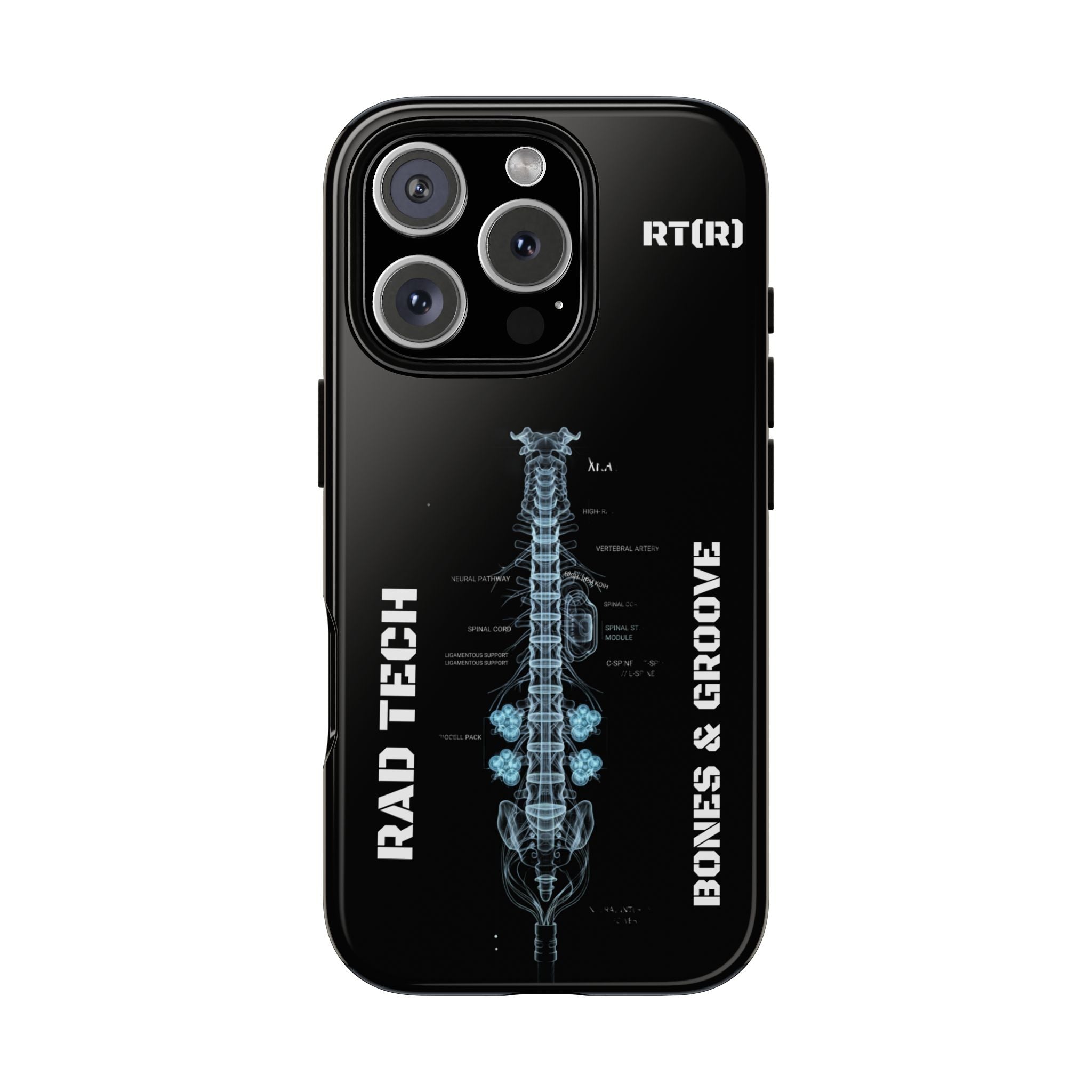 RAD TECH -Aesthetic Phone Case