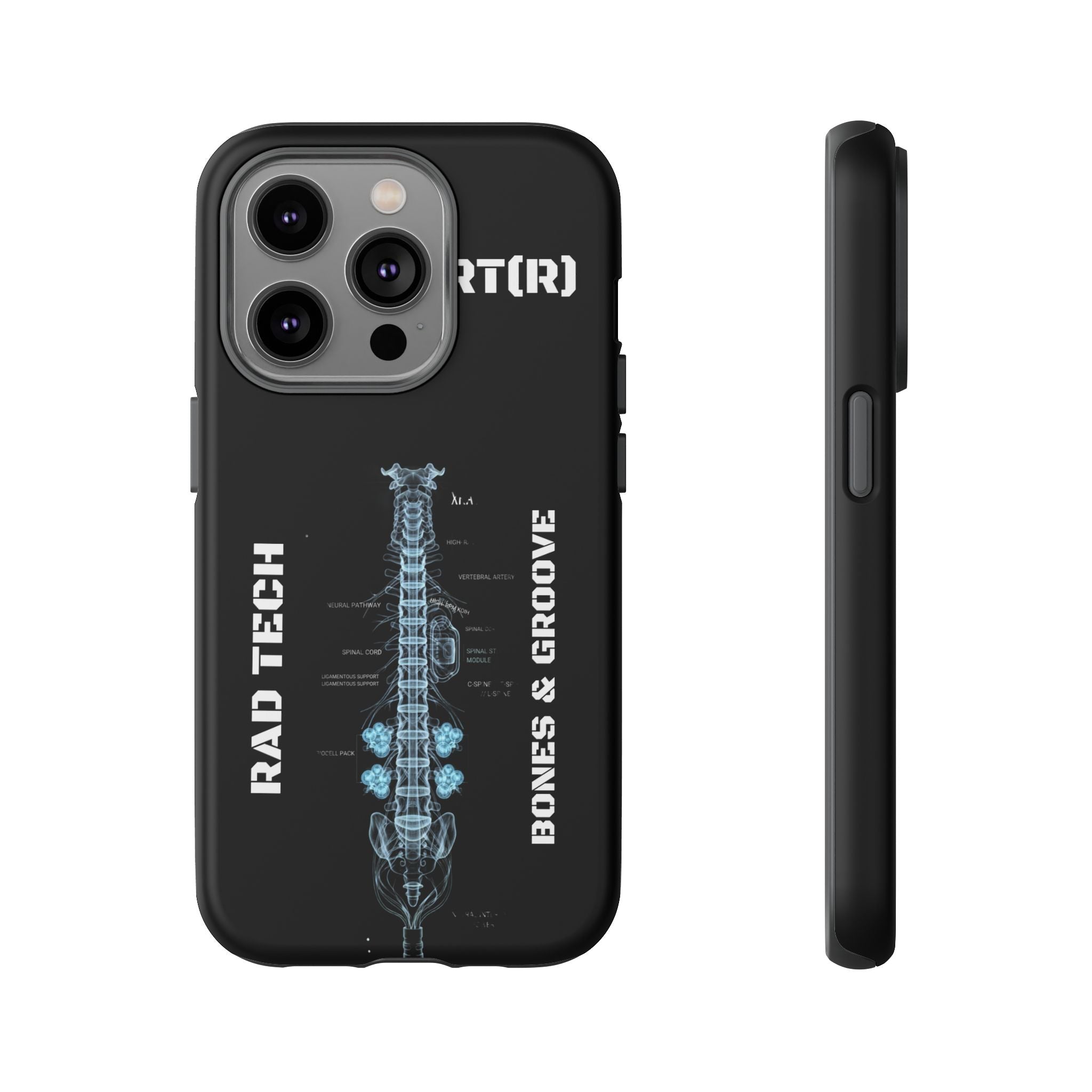 RAD TECH -Aesthetic Phone Case