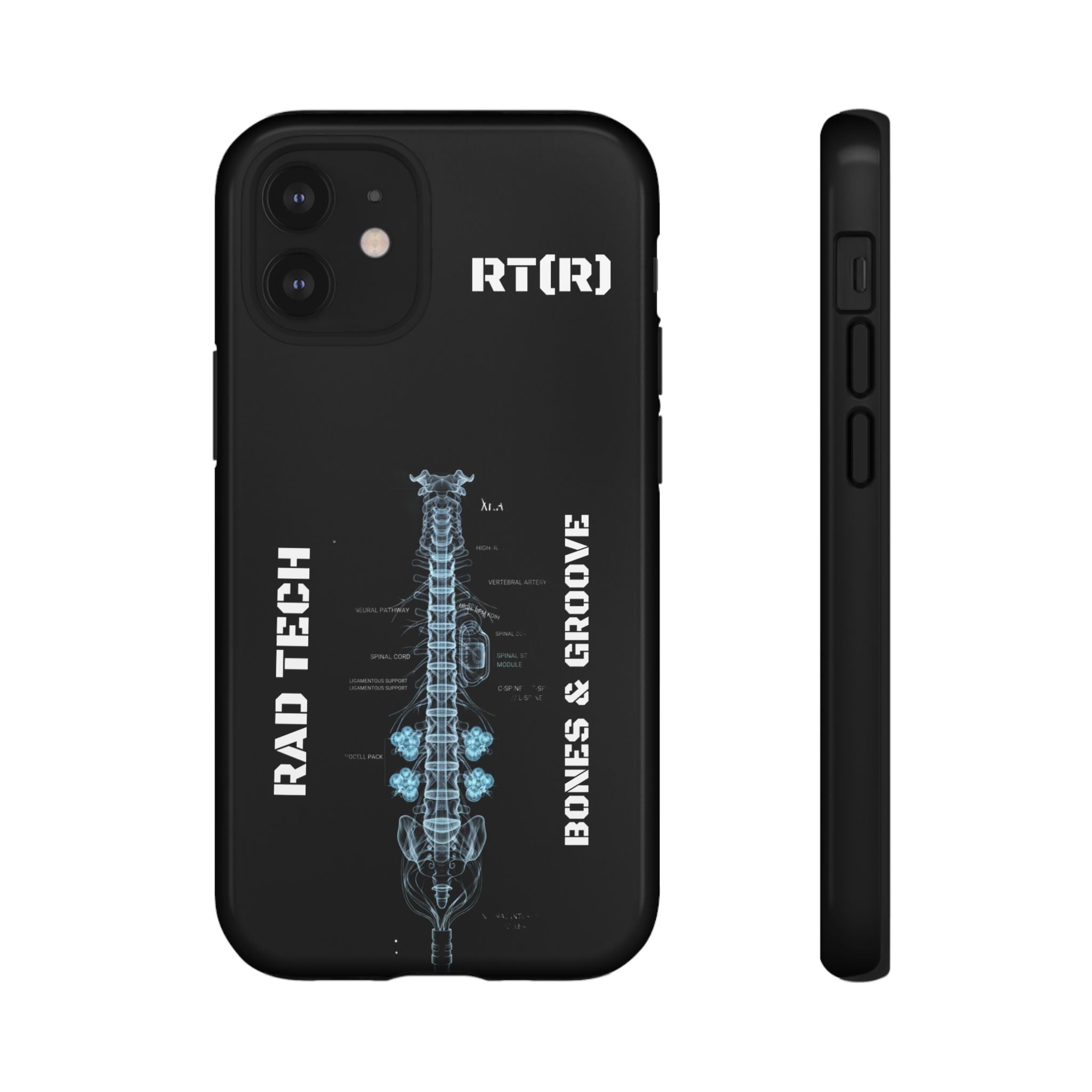 RAD TECH -Aesthetic Phone Case