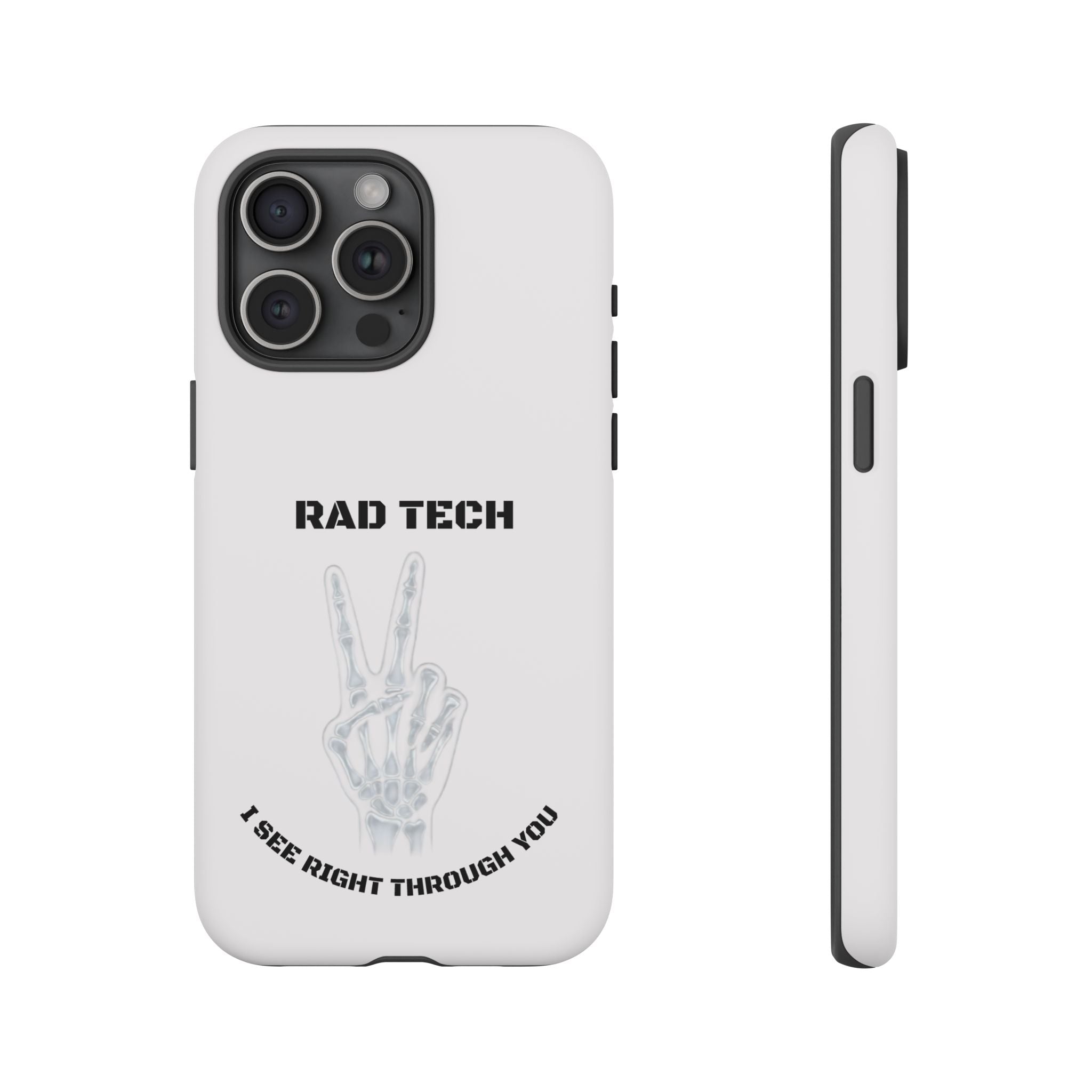 Rad Tech Phone Case — Skeleton Hand "I See Right Through You" X-ray Technician Gift