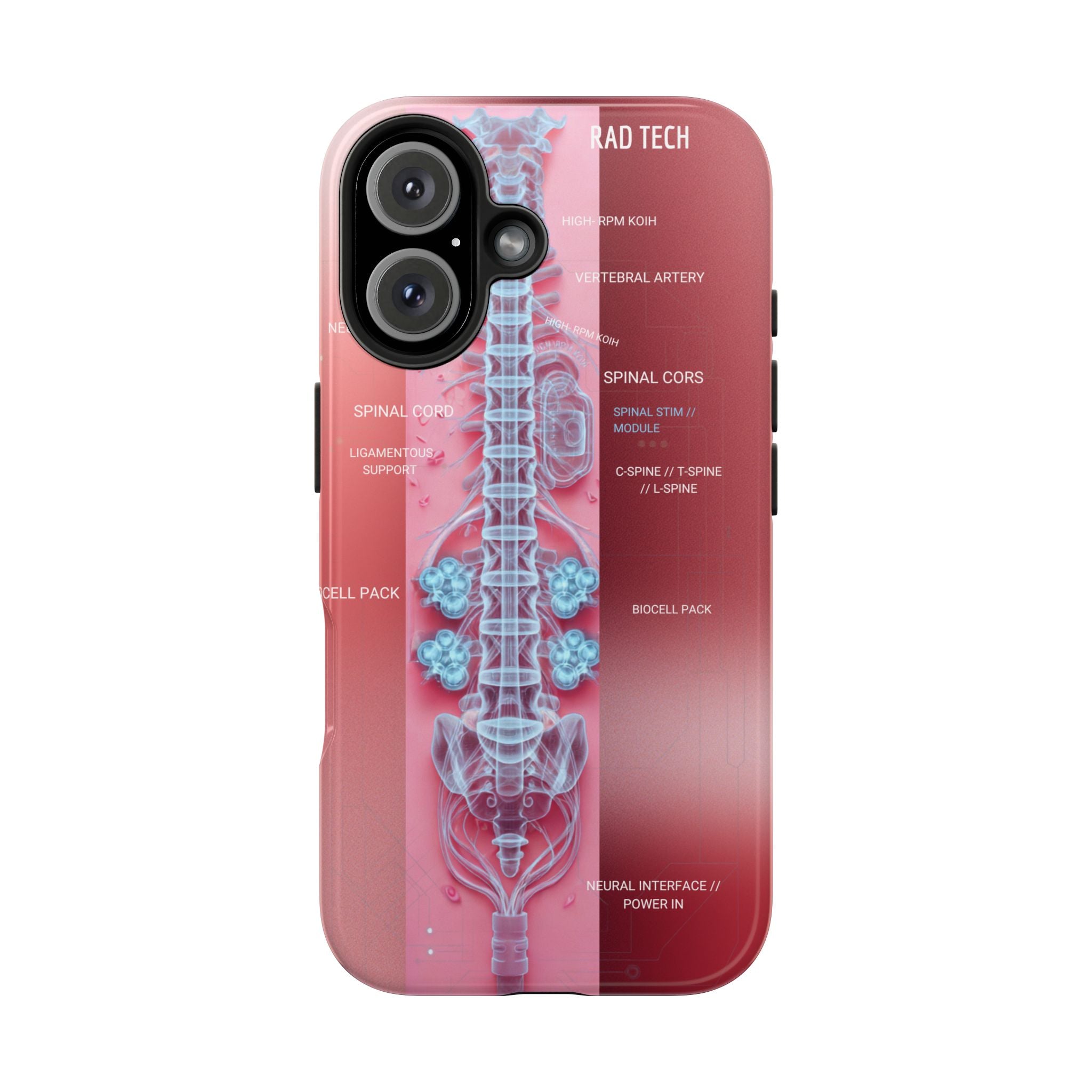 Anatomical Spine Tough Phone Case — Medical X-Ray Design, ‘Spinal Cord’ Labelled