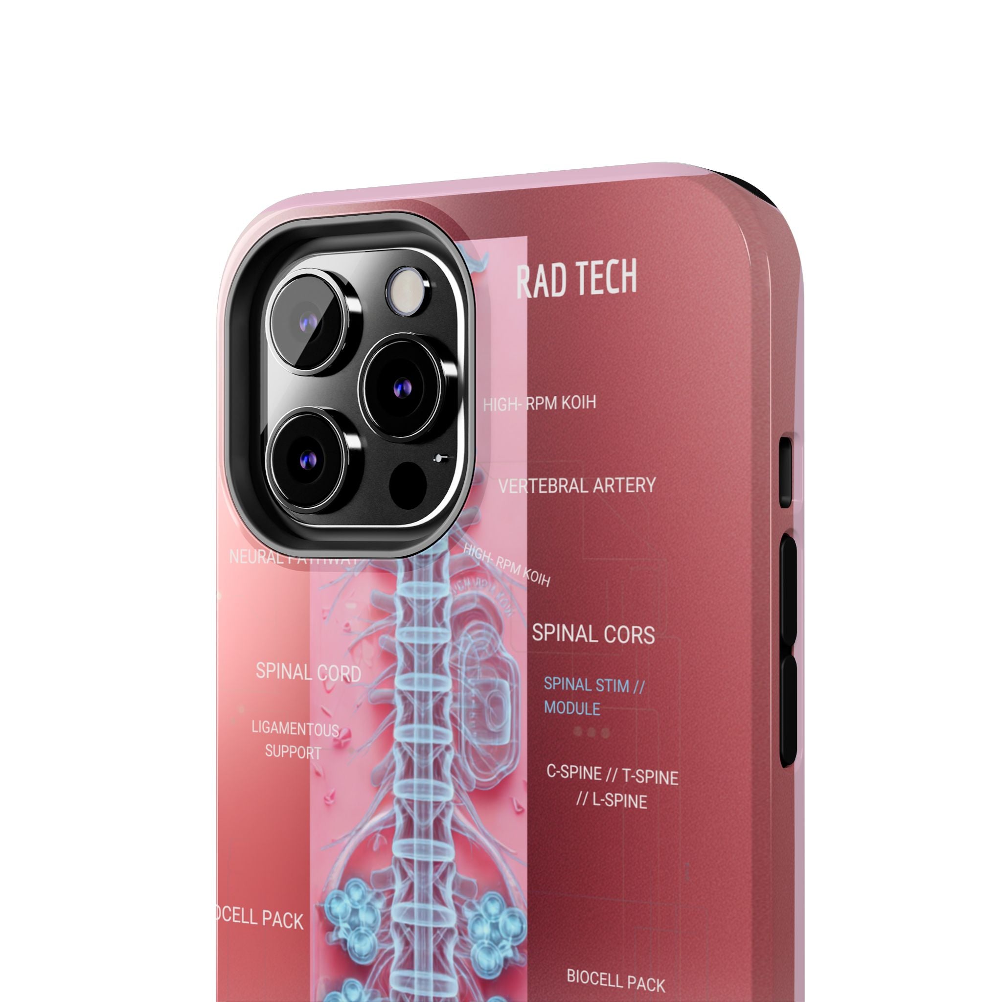 Anatomical Spine Tough Phone Case — Medical X-Ray Design, ‘Spinal Cord’ Labelled