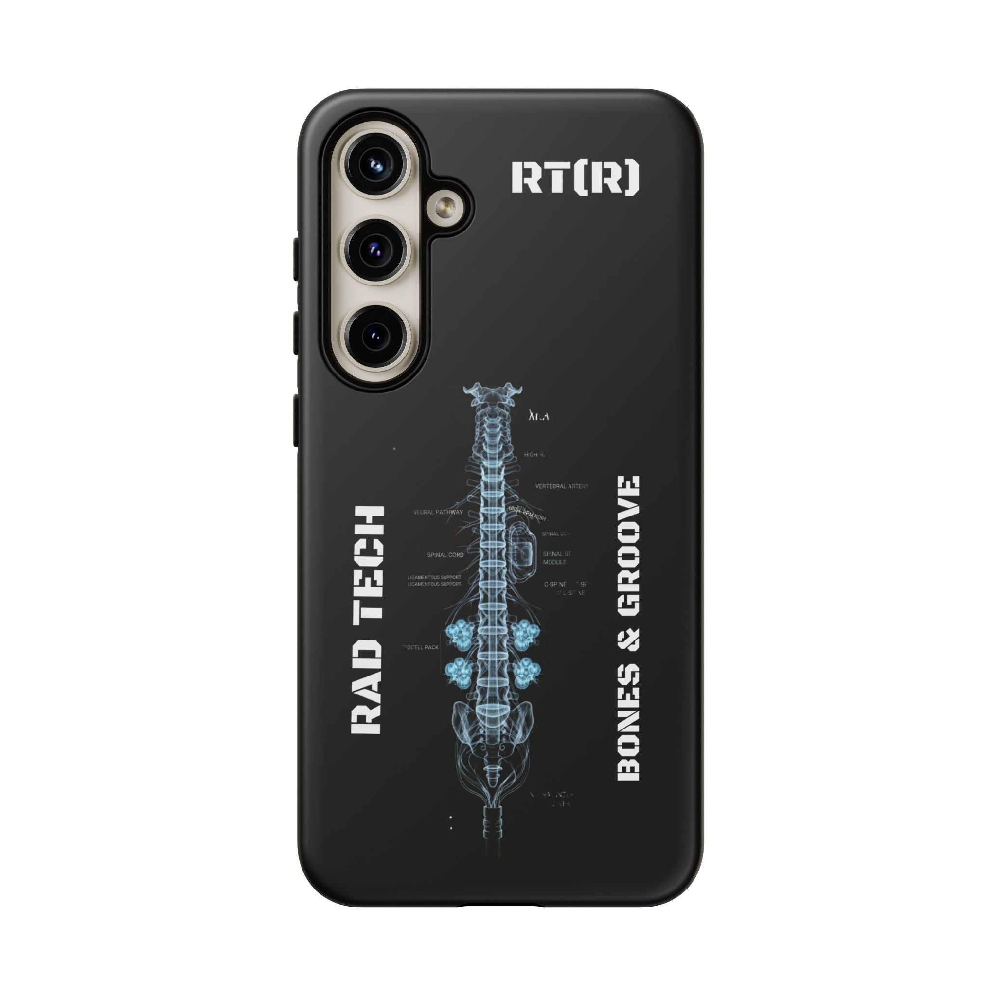 RAD TECH -Aesthetic Phone Case
