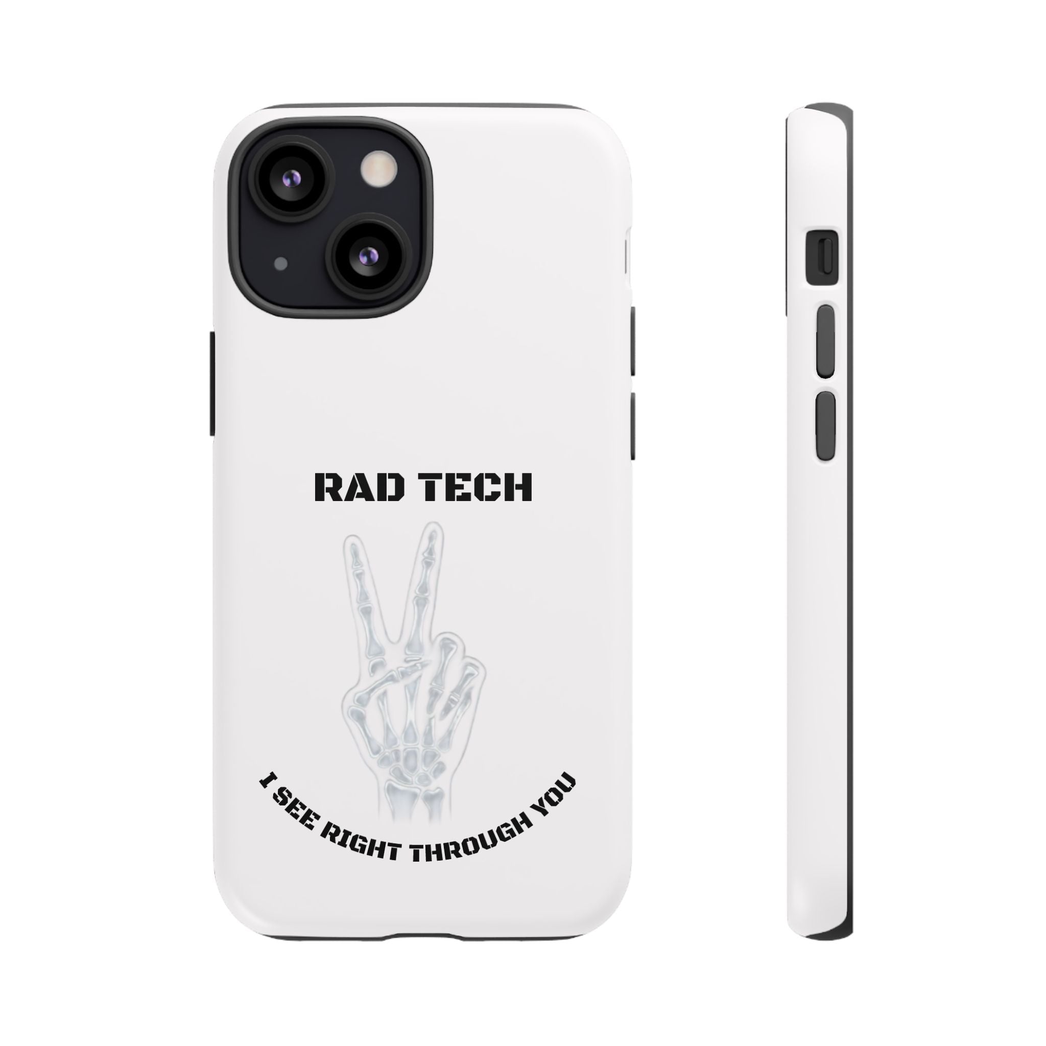 Rad Tech Phone Case — Skeleton Hand "I See Right Through You" X-ray Technician Gift