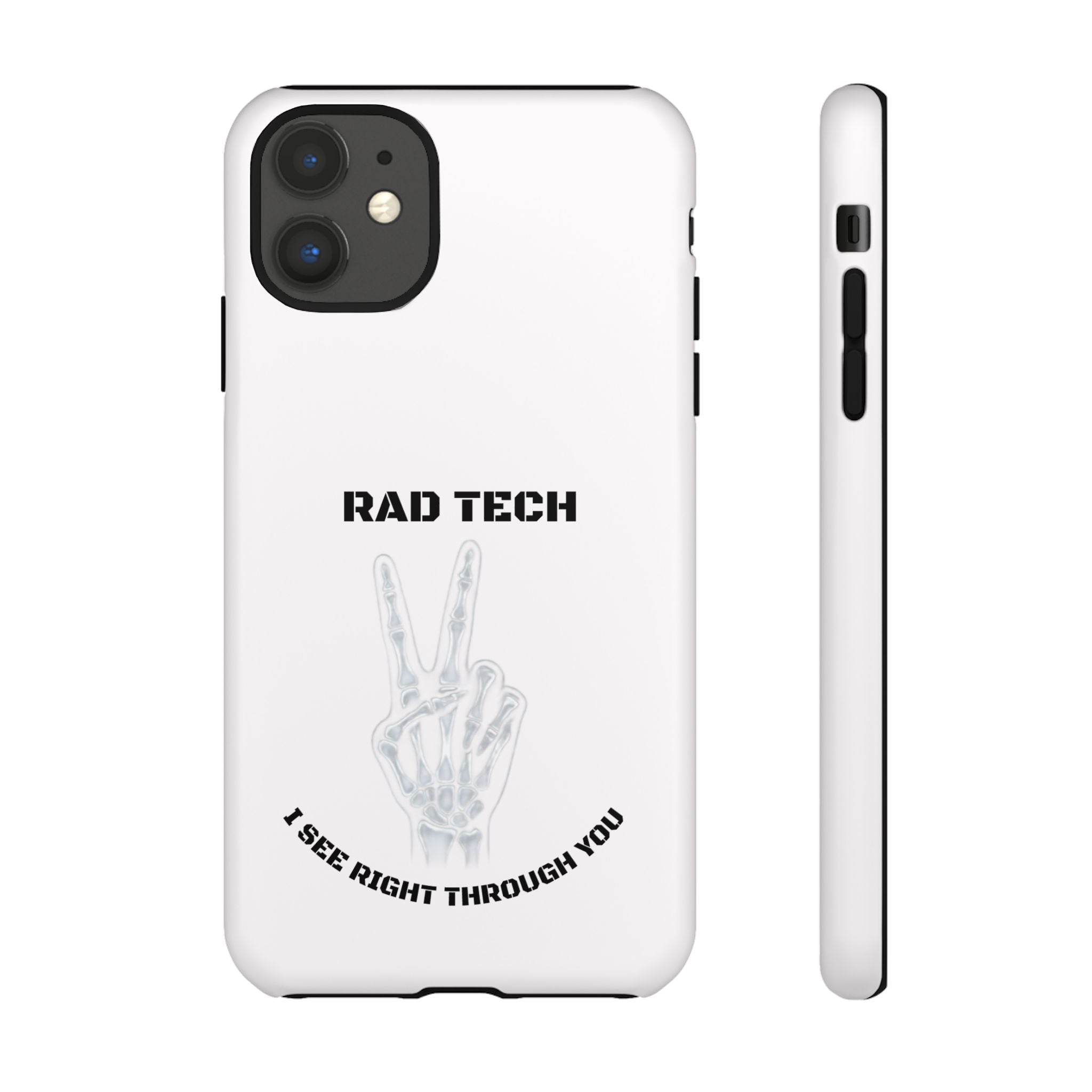Rad Tech Phone Case — Skeleton Hand "I See Right Through You" X-ray Technician Gift