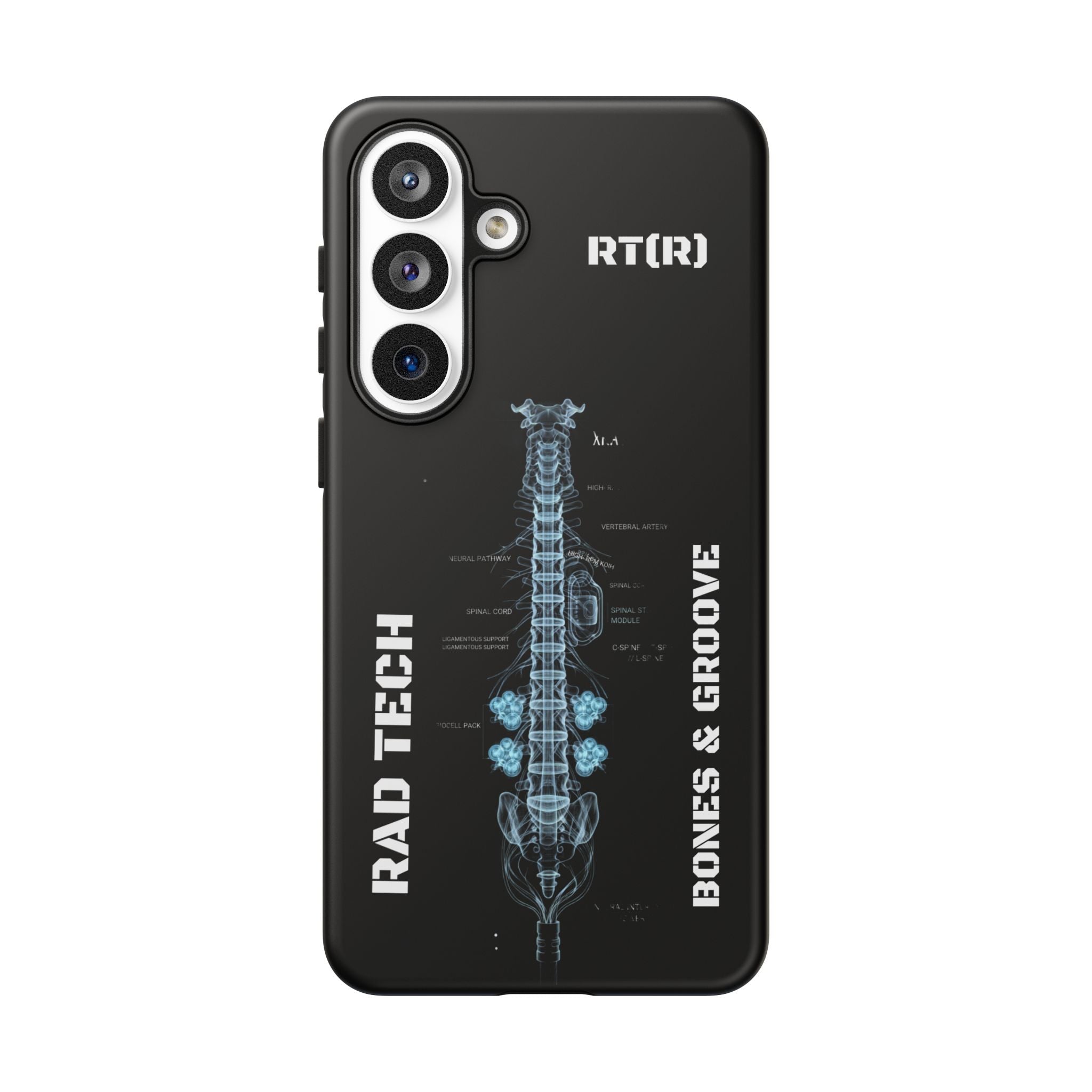RAD TECH -Aesthetic Phone Case