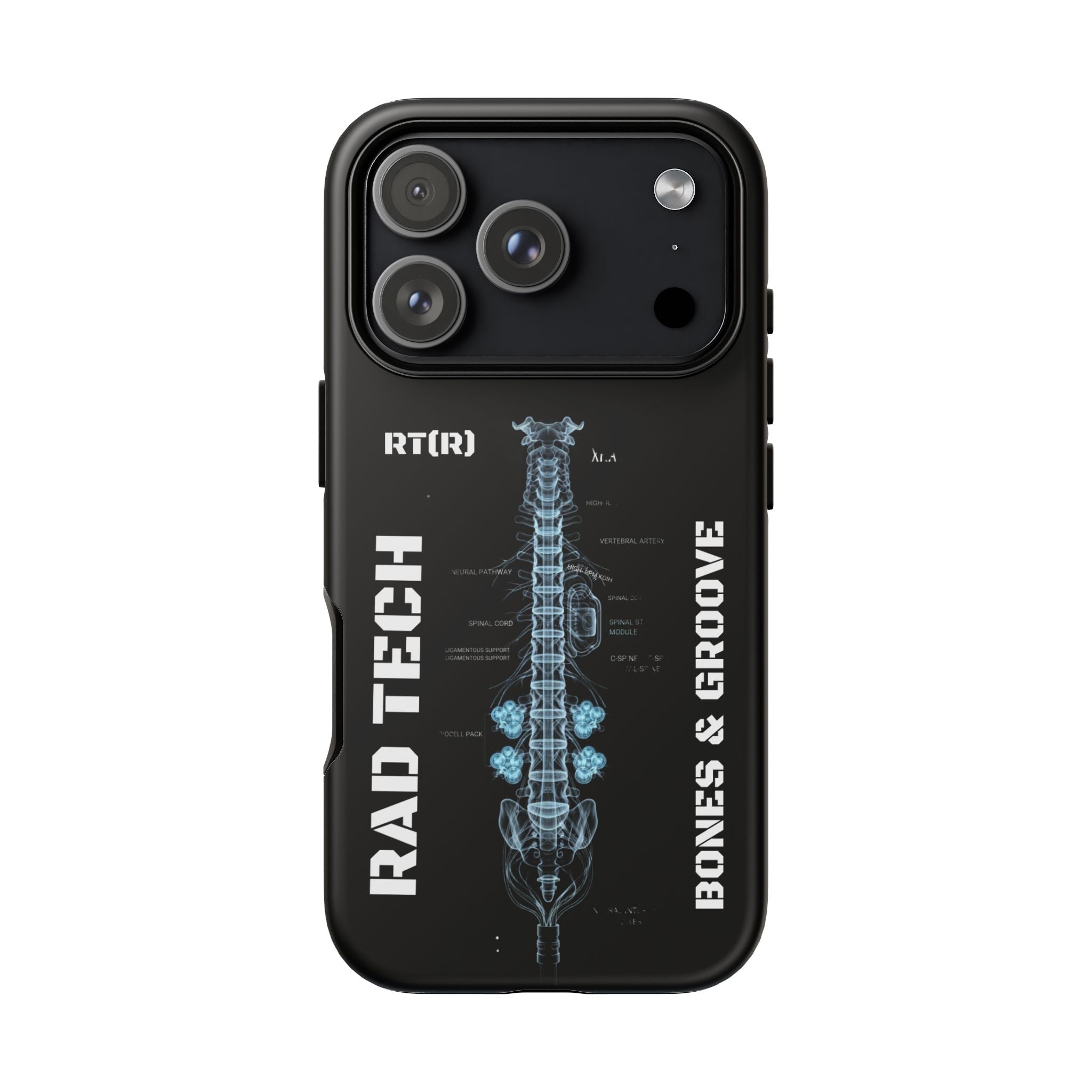 RAD TECH -Aesthetic Phone Case