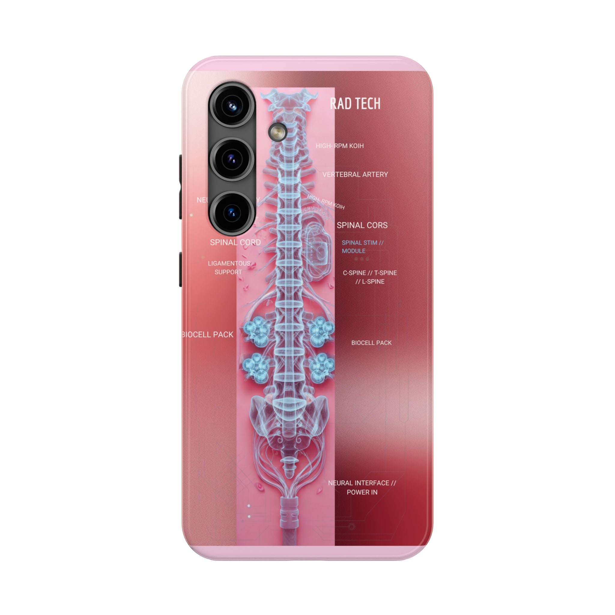 Anatomical Spine Tough Phone Case — Medical X-Ray Design, ‘Spinal Cord’ Labelled