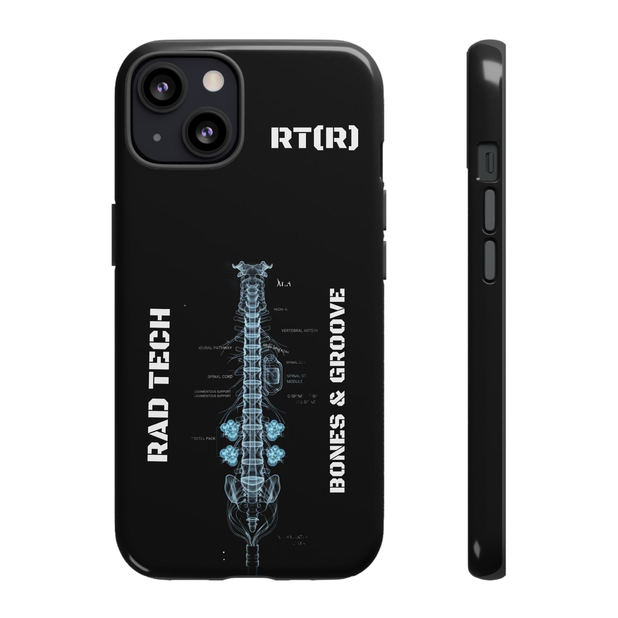 RAD TECH -Aesthetic Phone Case