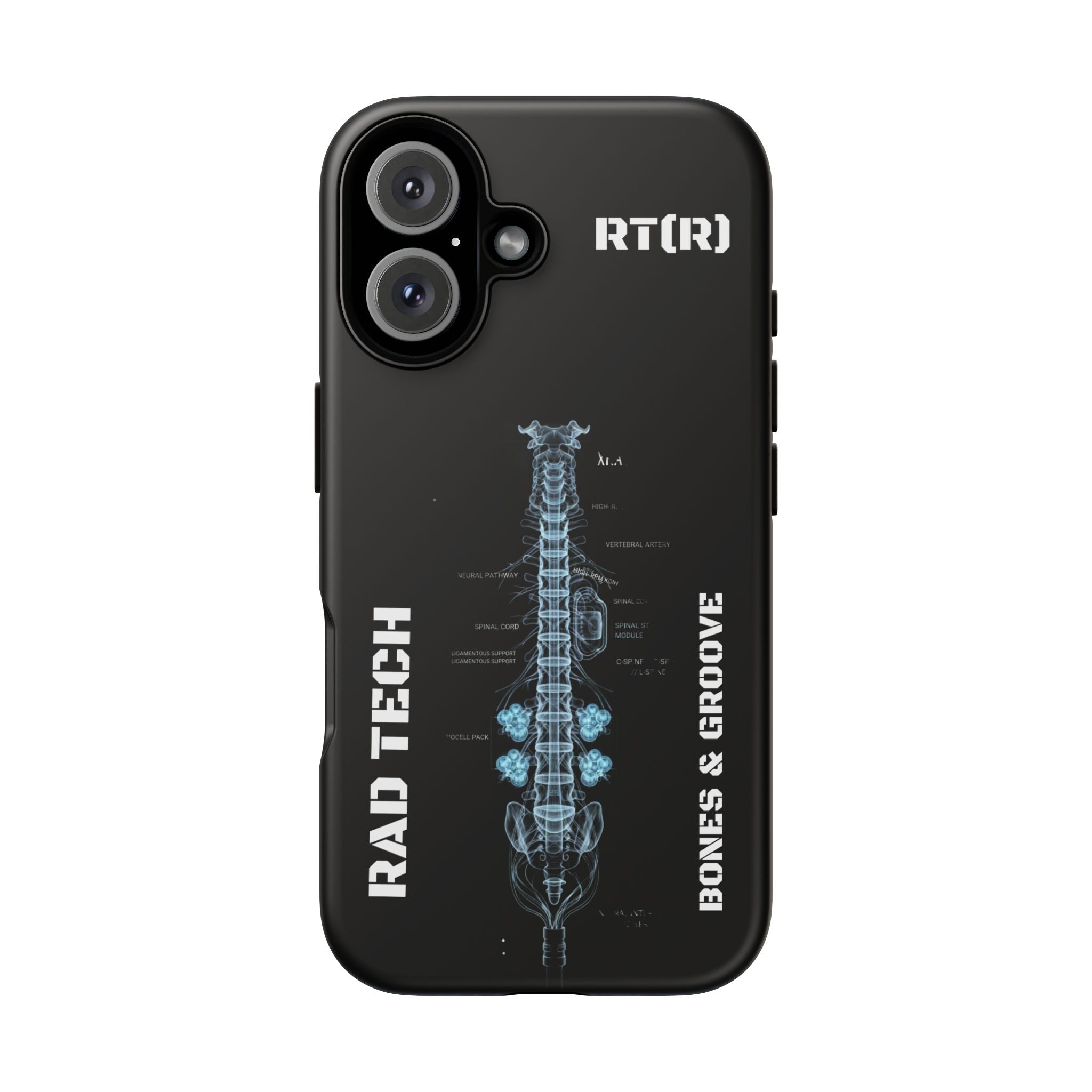RAD TECH -Aesthetic Phone Case
