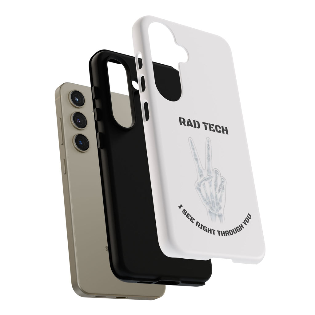 Rad Tech Phone Case — Skeleton Hand "I See Right Through You" X-ray Technician Gift