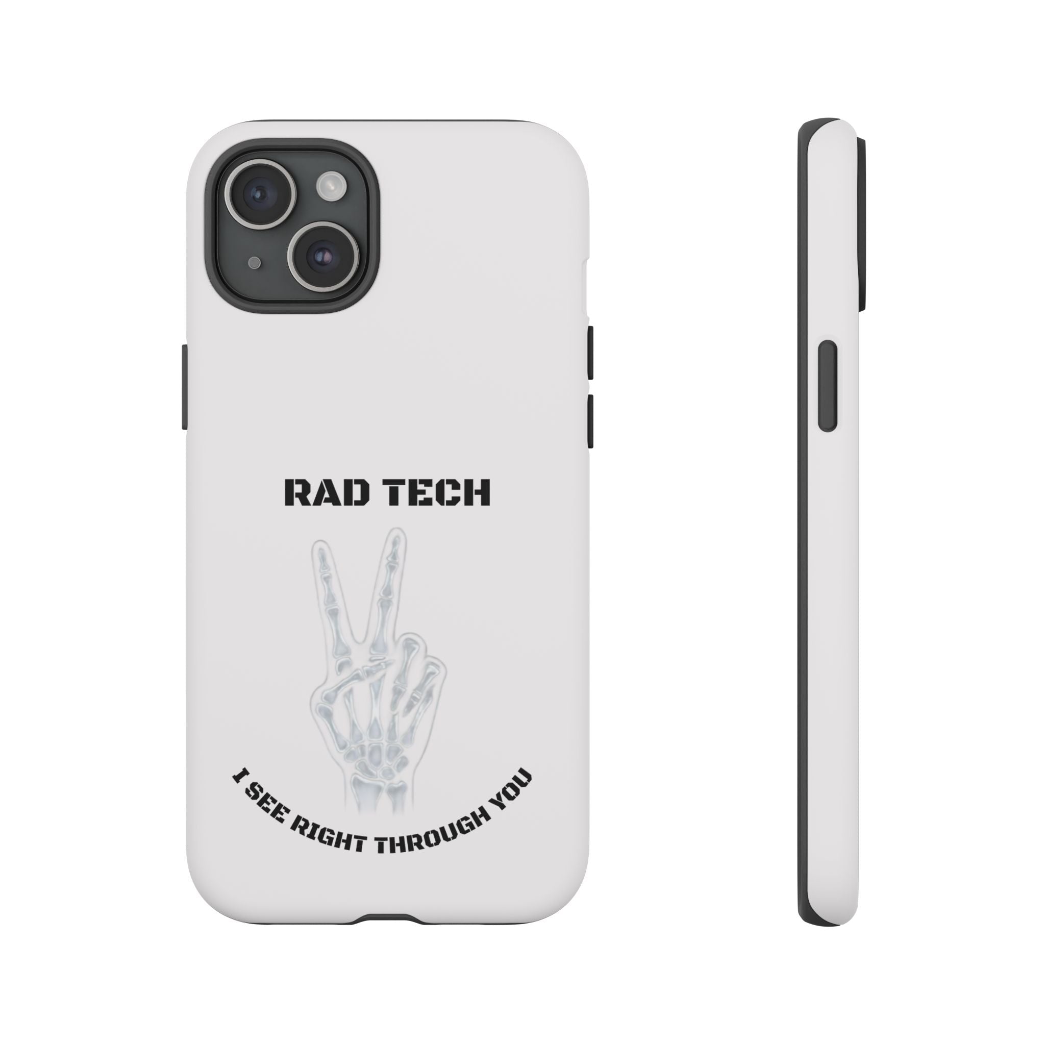 Rad Tech Phone Case — Skeleton Hand "I See Right Through You" X-ray Technician Gift