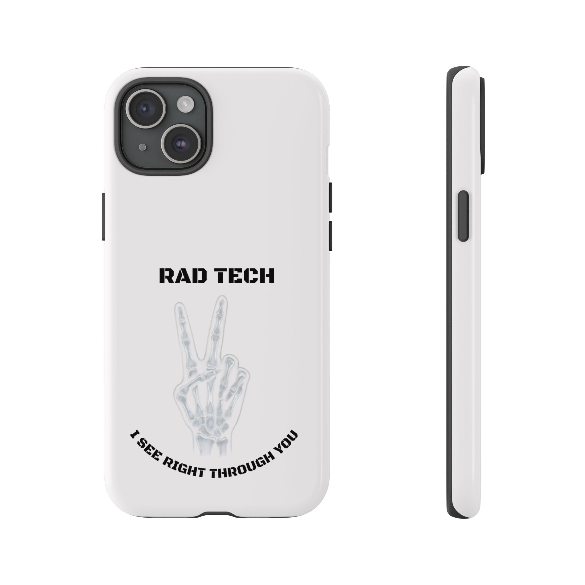 Rad Tech Phone Case — Skeleton Hand "I See Right Through You" X-ray Technician Gift