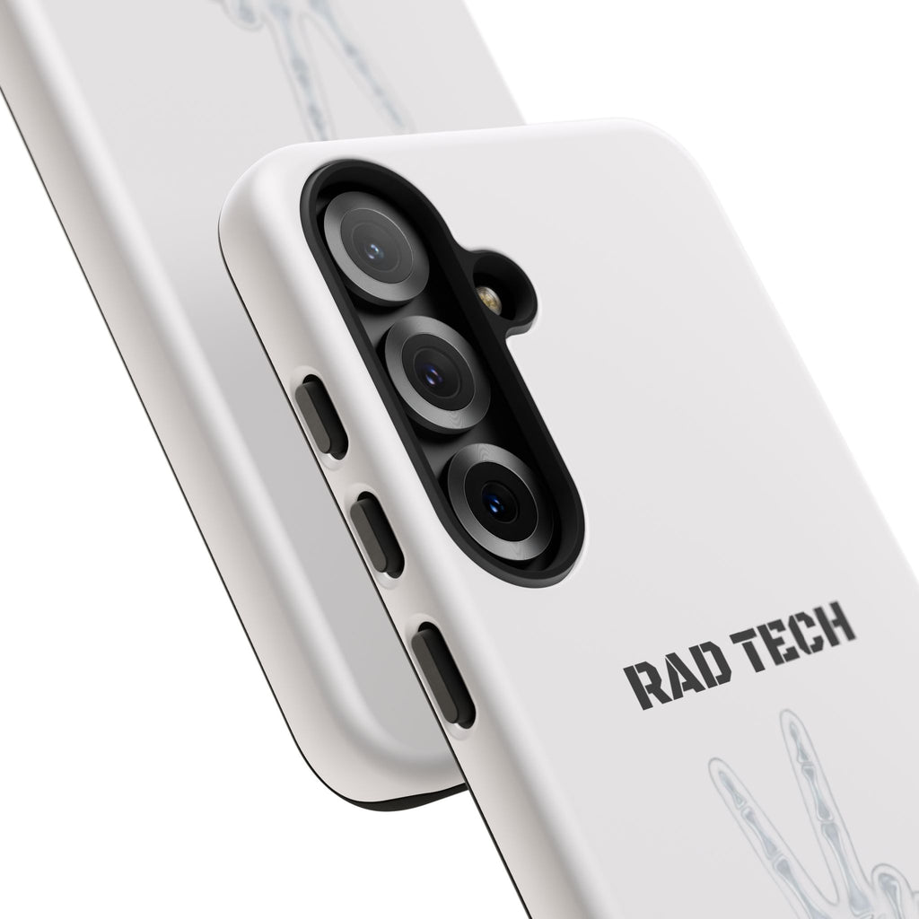 Rad Tech Phone Case — Skeleton Hand "I See Right Through You" X-ray Technician Gift
