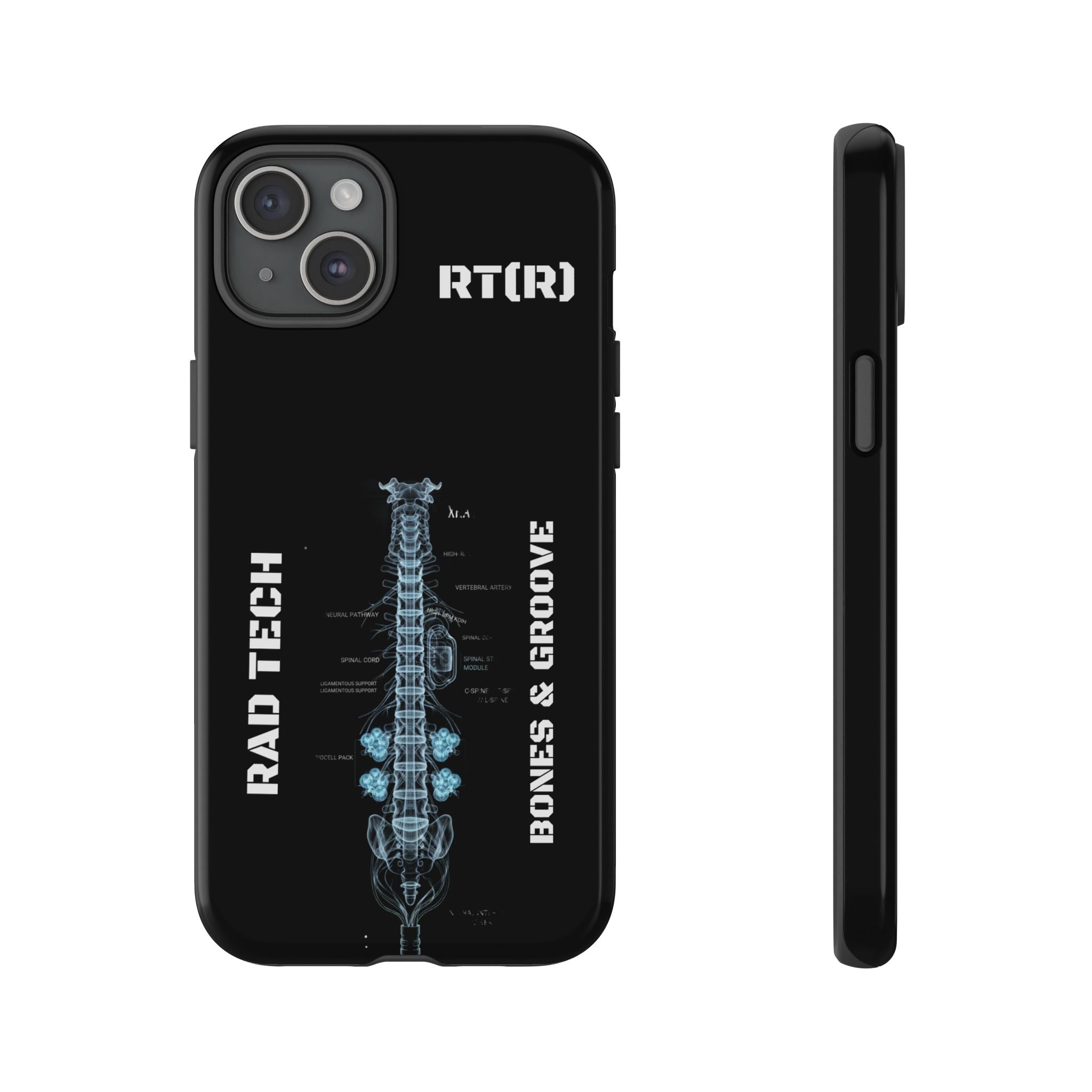 RAD TECH -Aesthetic Phone Case