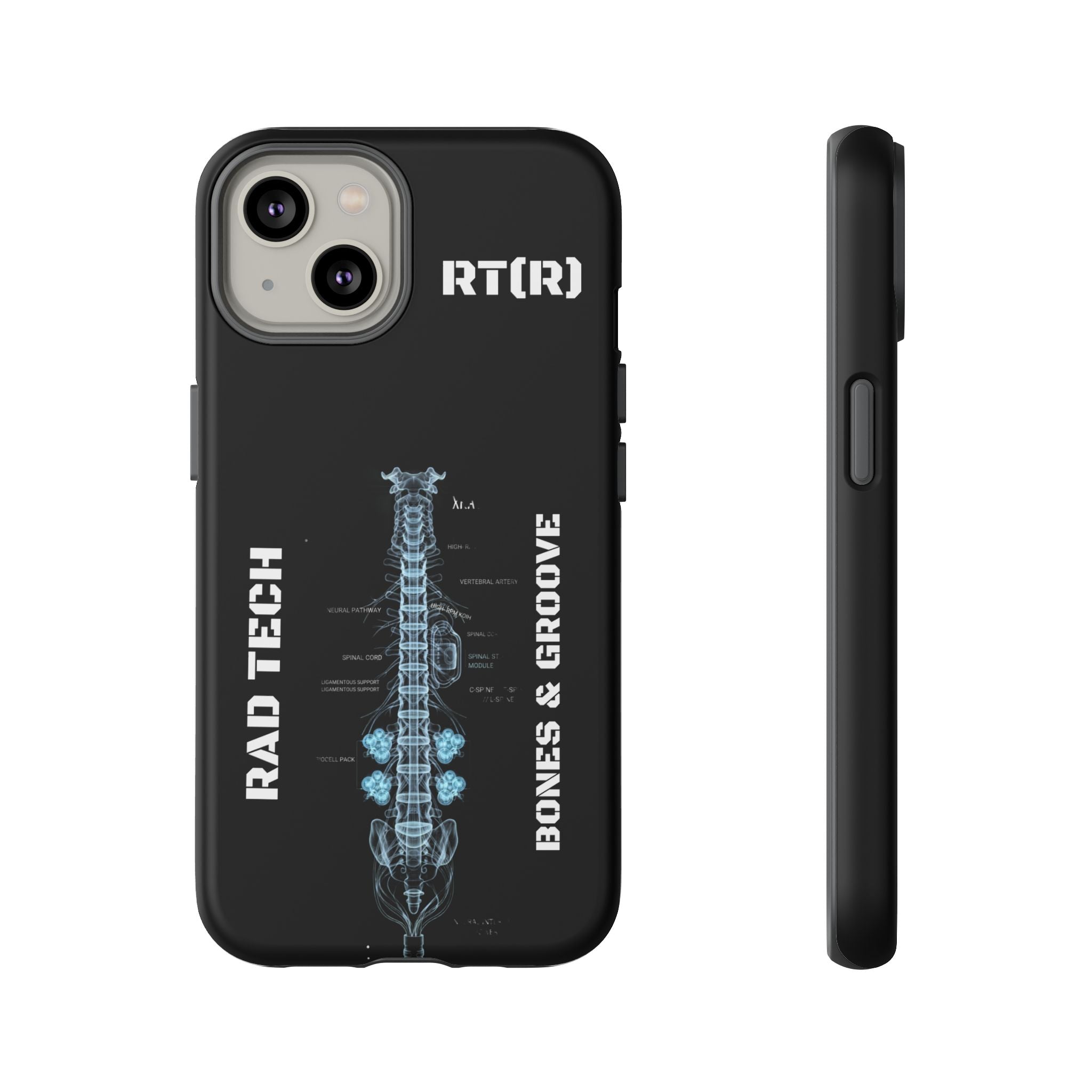 RAD TECH -Aesthetic Phone Case