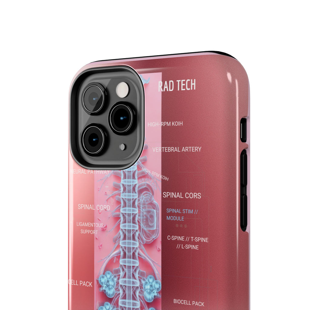 Anatomical Spine Tough Phone Case — Medical X-Ray Design, ‘Spinal Cord’ Labelled