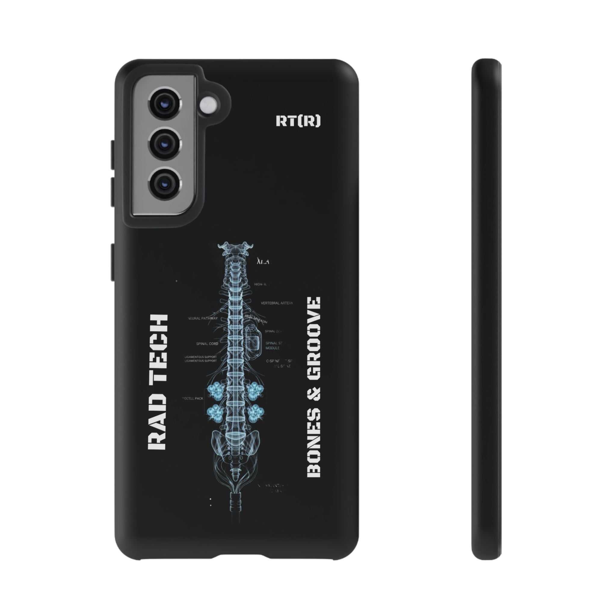 RAD TECH -Aesthetic Phone Case