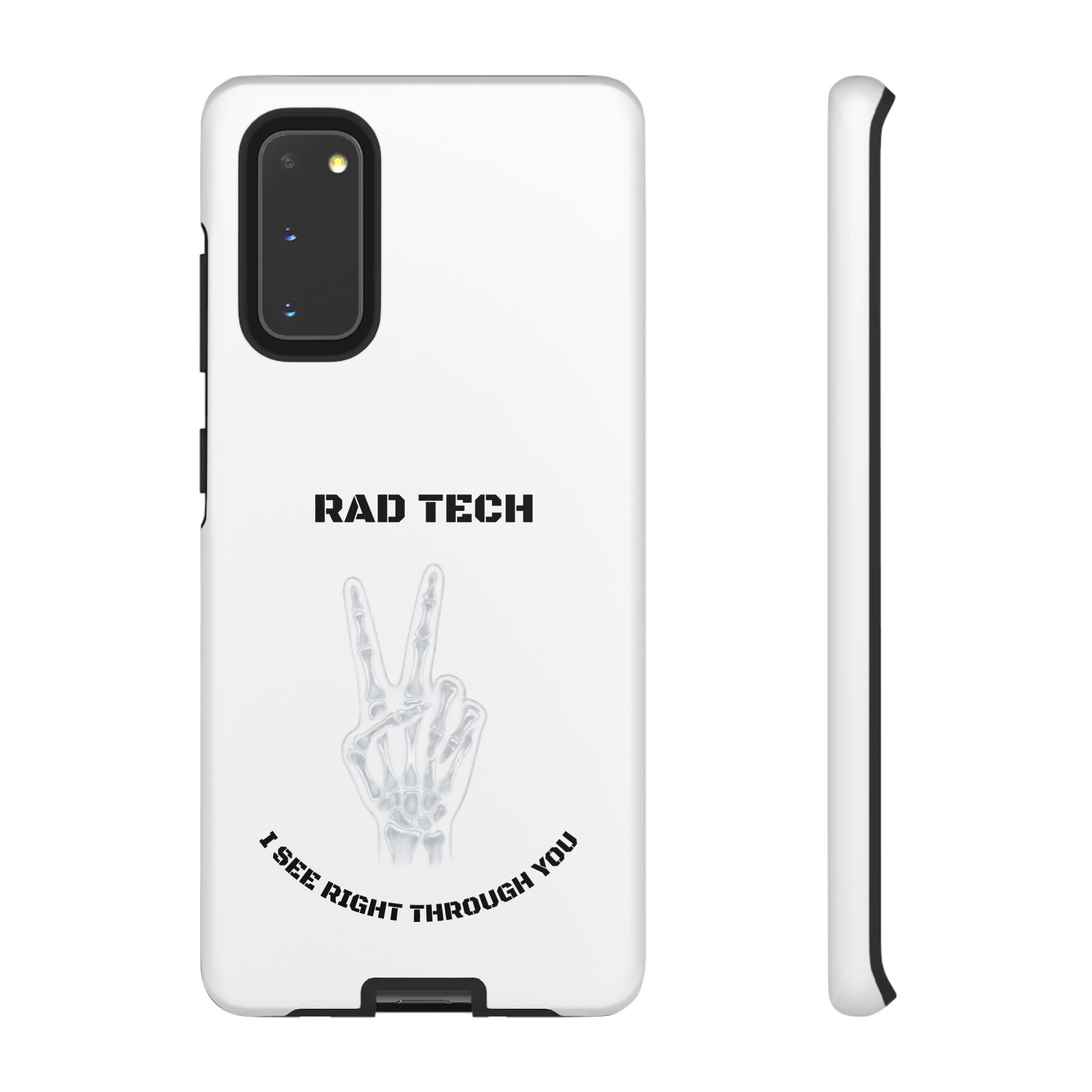 Rad Tech Phone Case — Skeleton Hand "I See Right Through You" X-ray Technician Gift