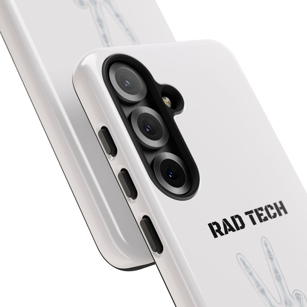 Rad Tech Phone Case — Skeleton Hand "I See Right Through You" X-ray Technician Gift