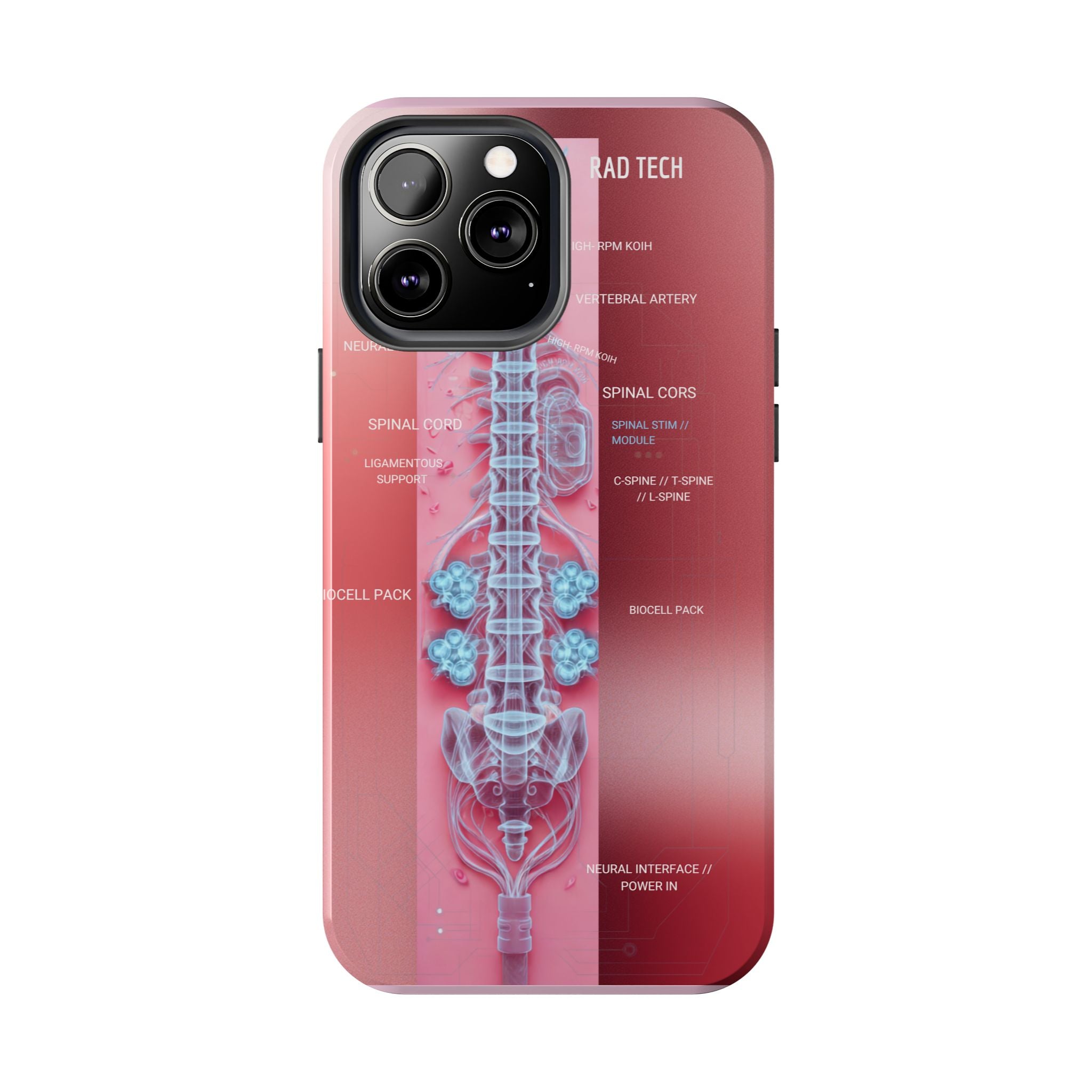 Anatomical Spine Tough Phone Case — Medical X-Ray Design, ‘Spinal Cord’ Labelled
