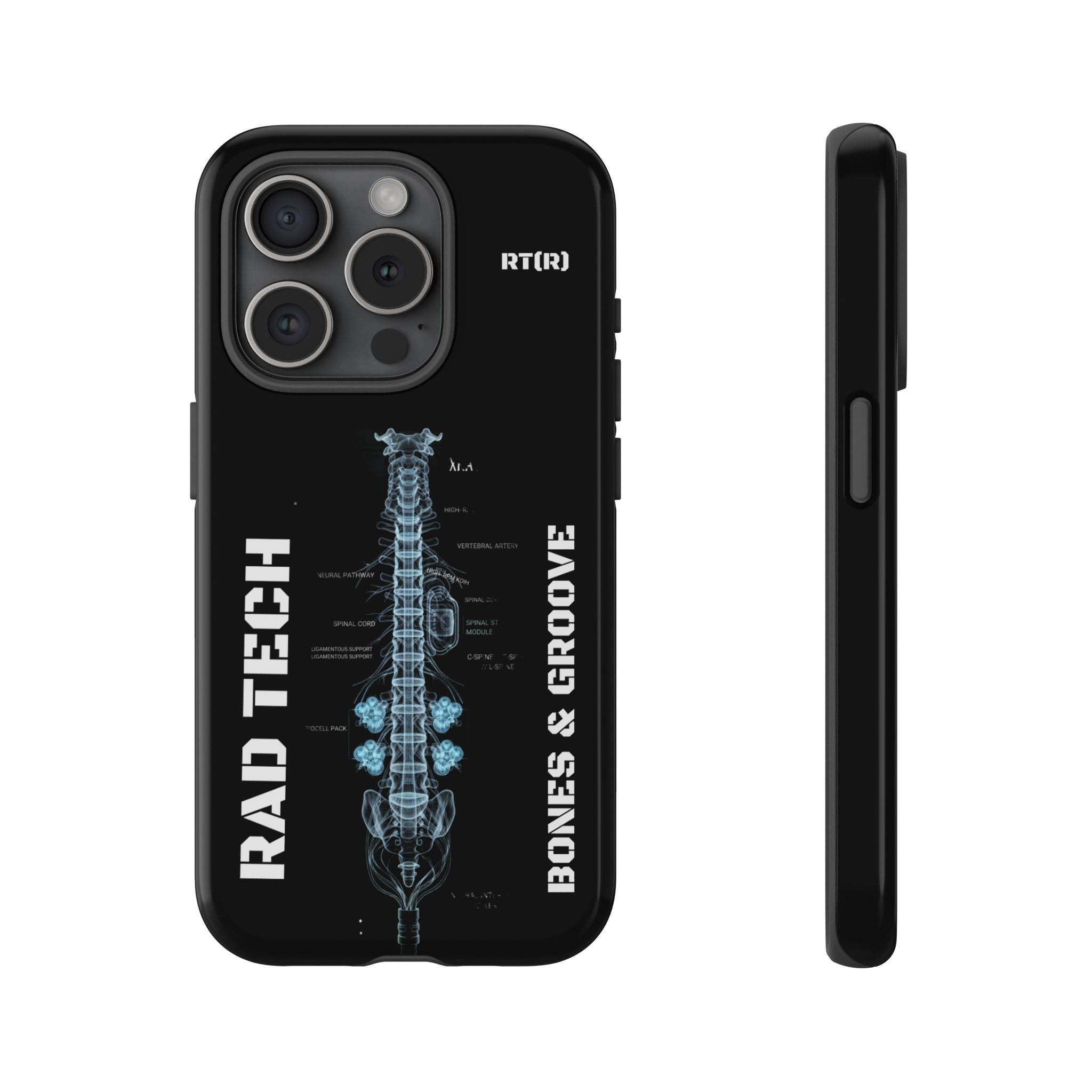 RAD TECH -Aesthetic Phone Case