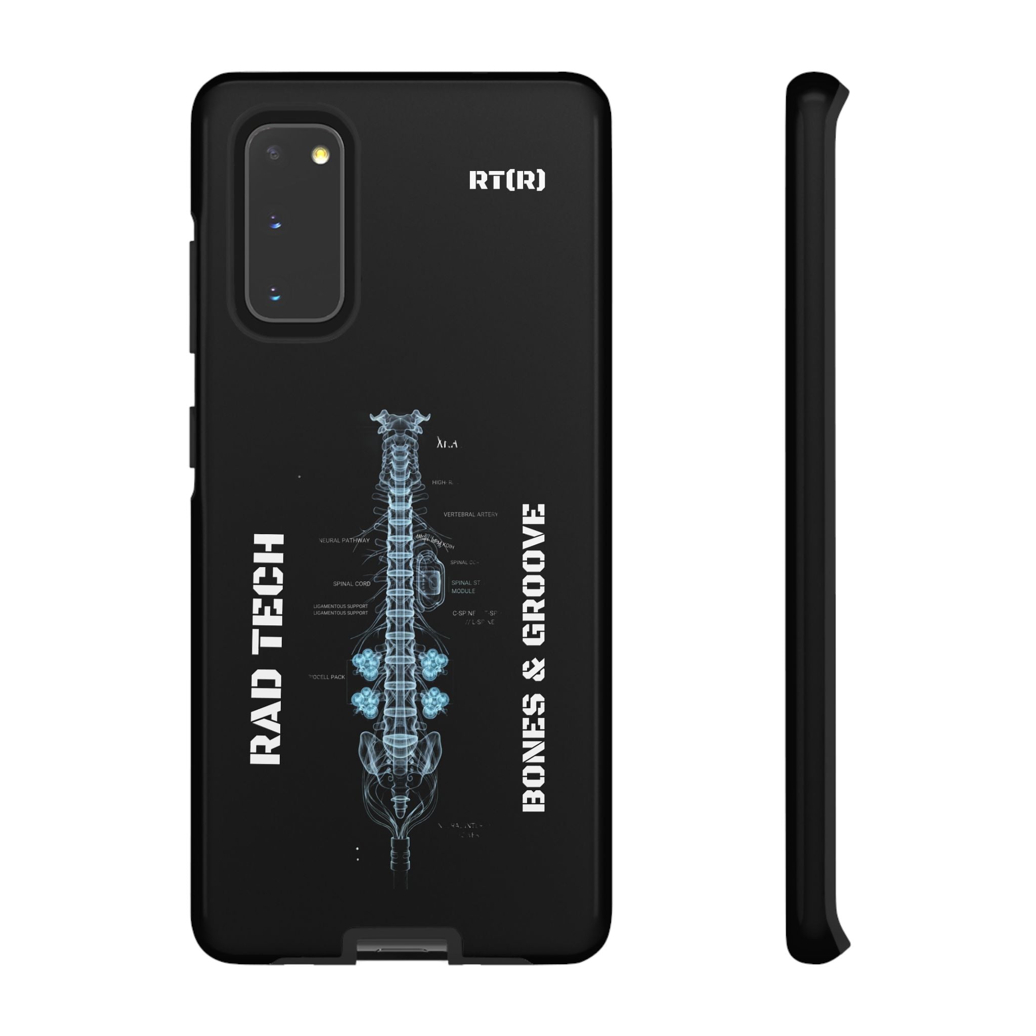 RAD TECH -Aesthetic Phone Case