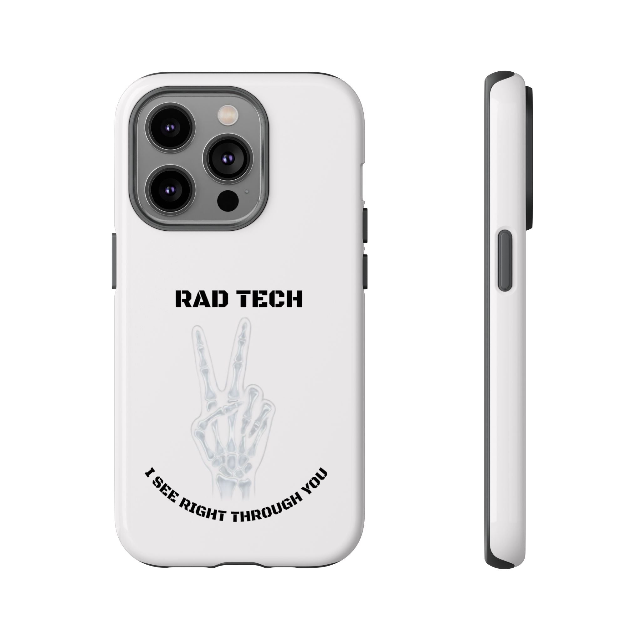 Rad Tech Phone Case — Skeleton Hand "I See Right Through You" X-ray Technician Gift