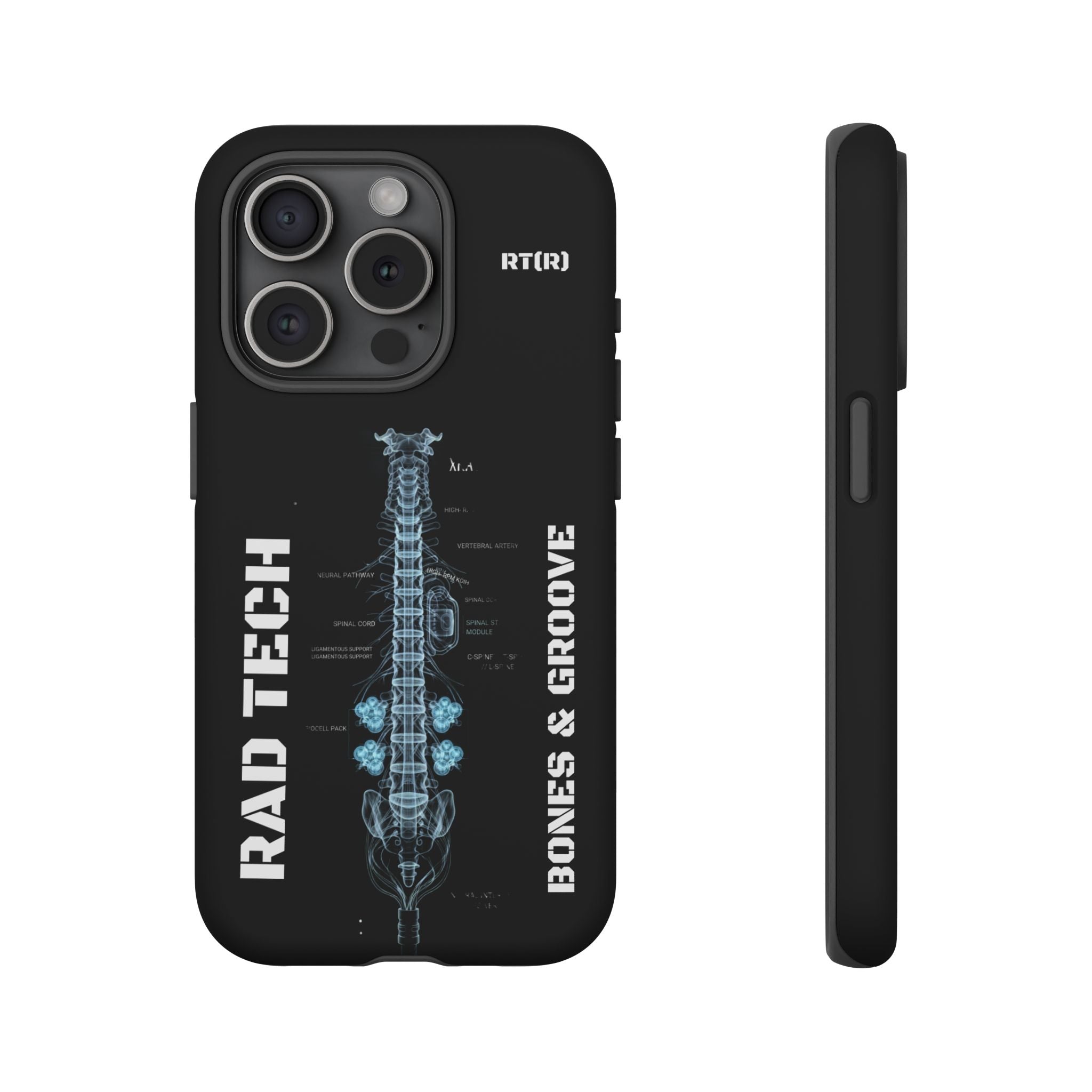RAD TECH -Aesthetic Phone Case