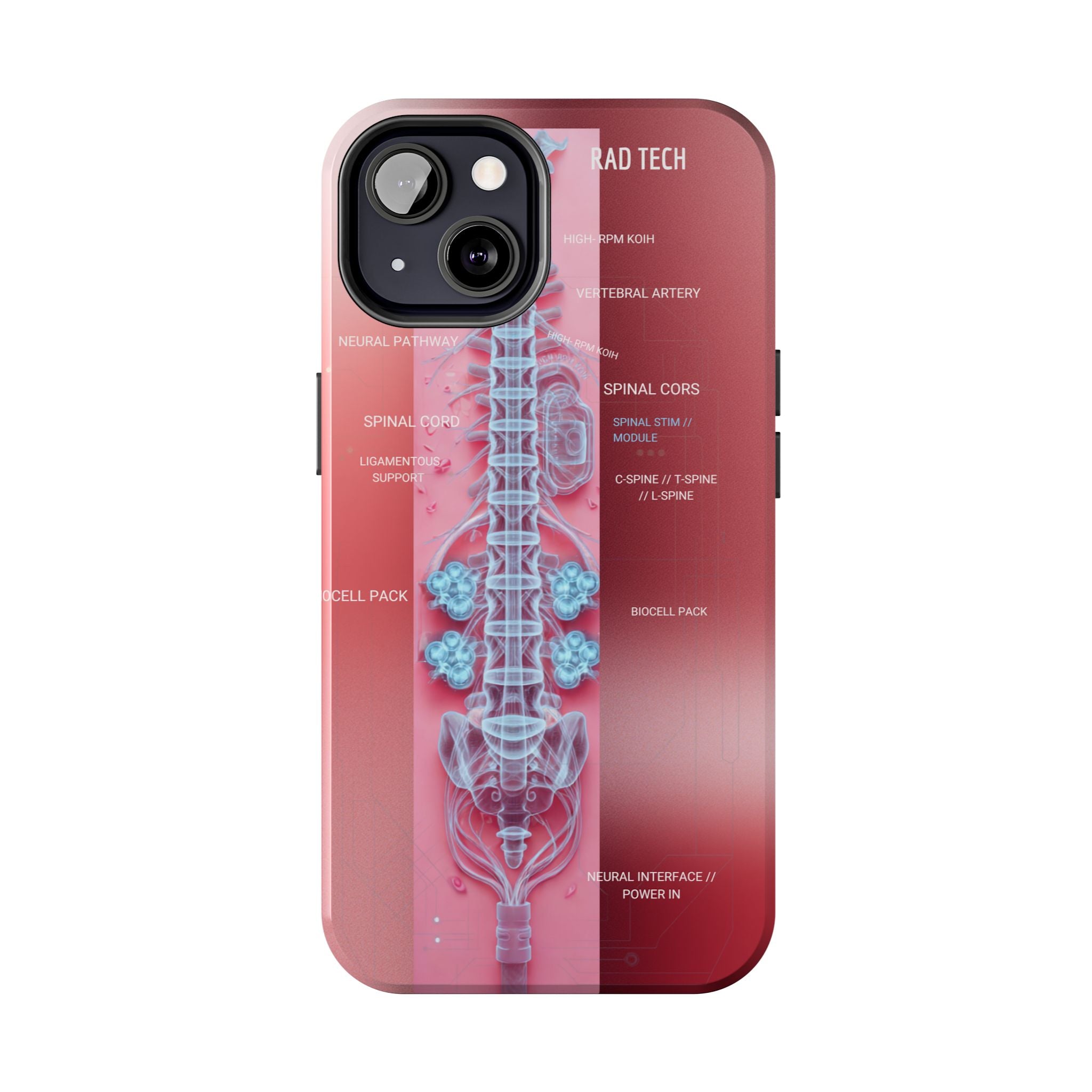 Anatomical Spine Tough Phone Case — Medical X-Ray Design, ‘Spinal Cord’ Labelled
