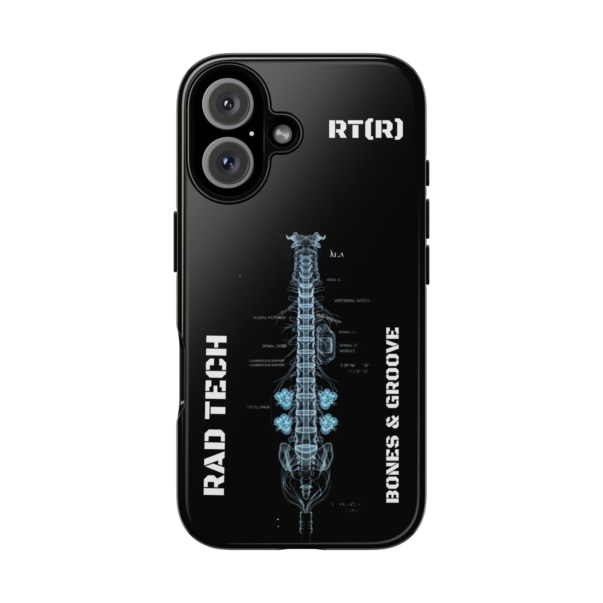 RAD TECH -Aesthetic Phone Case