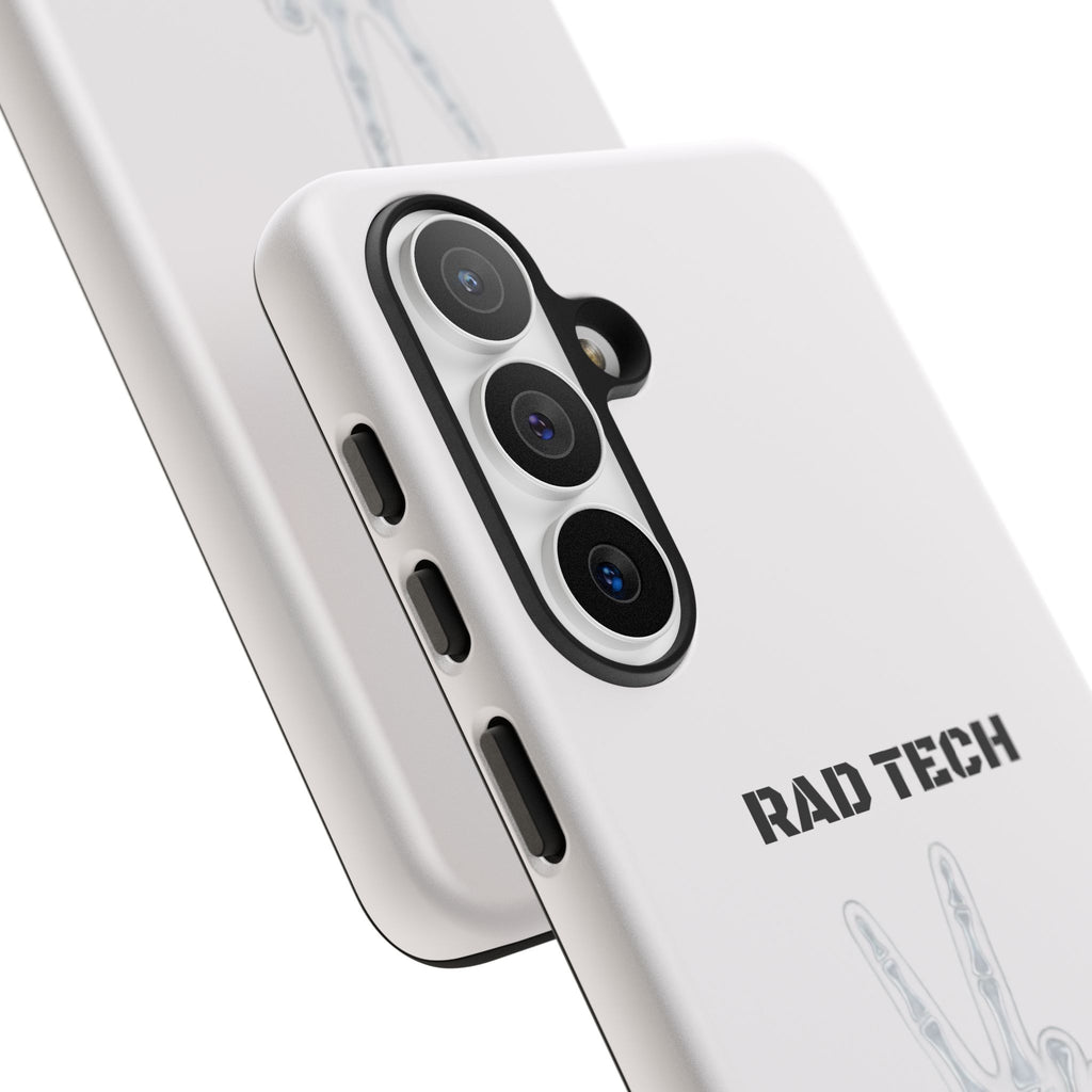 Rad Tech Phone Case — Skeleton Hand "I See Right Through You" X-ray Technician Gift