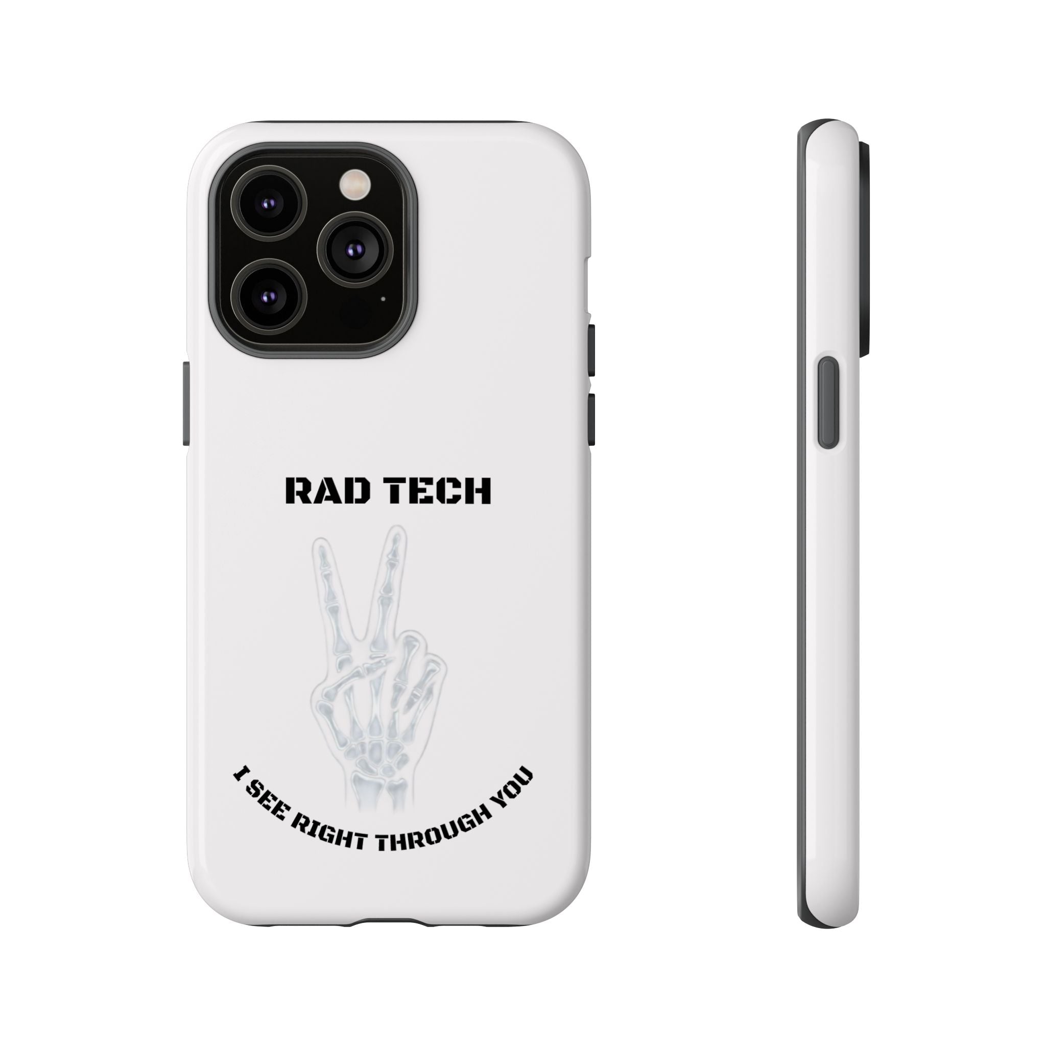 Rad Tech Phone Case — Skeleton Hand "I See Right Through You" X-ray Technician Gift