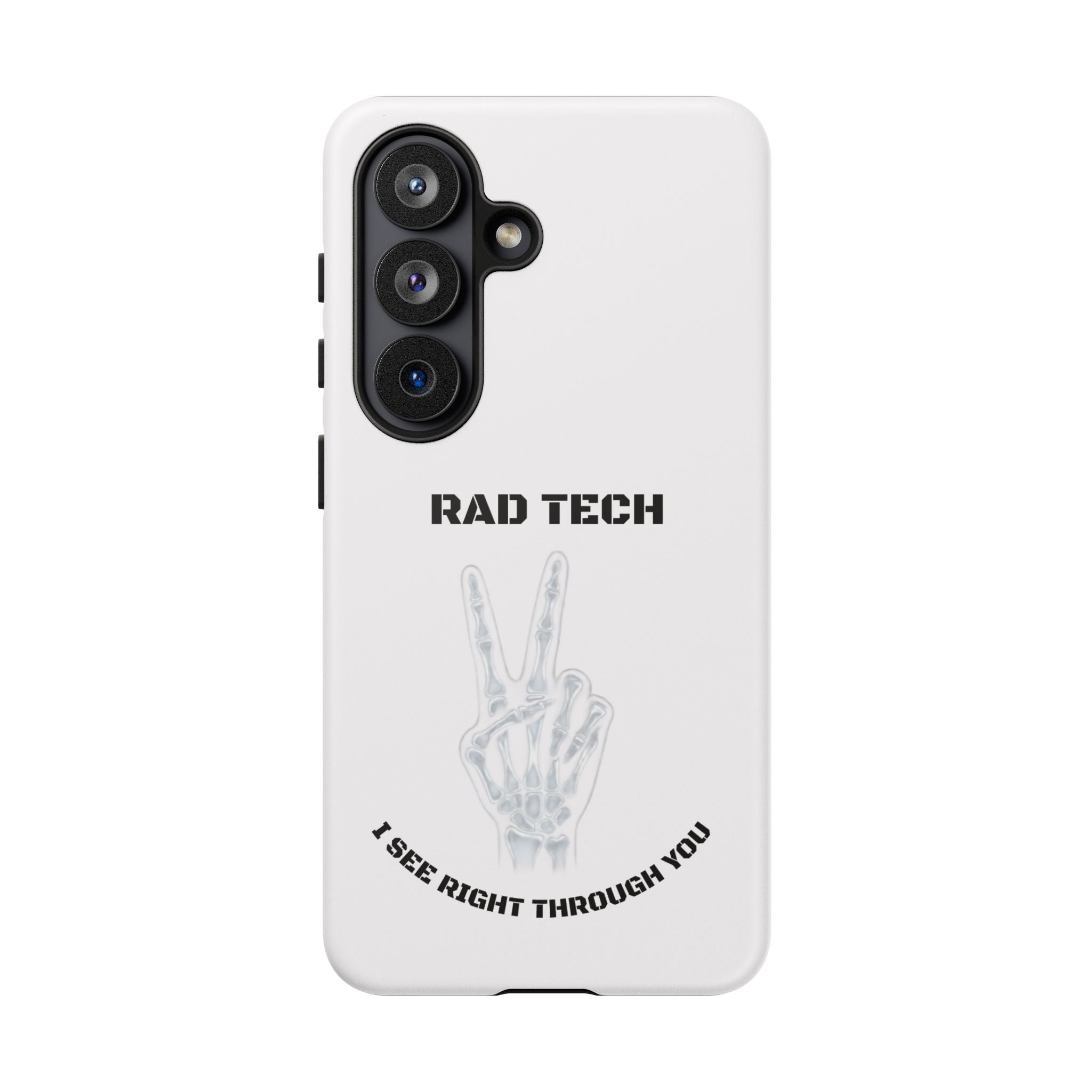 Rad Tech Phone Case — Skeleton Hand "I See Right Through You" X-ray Technician Gift