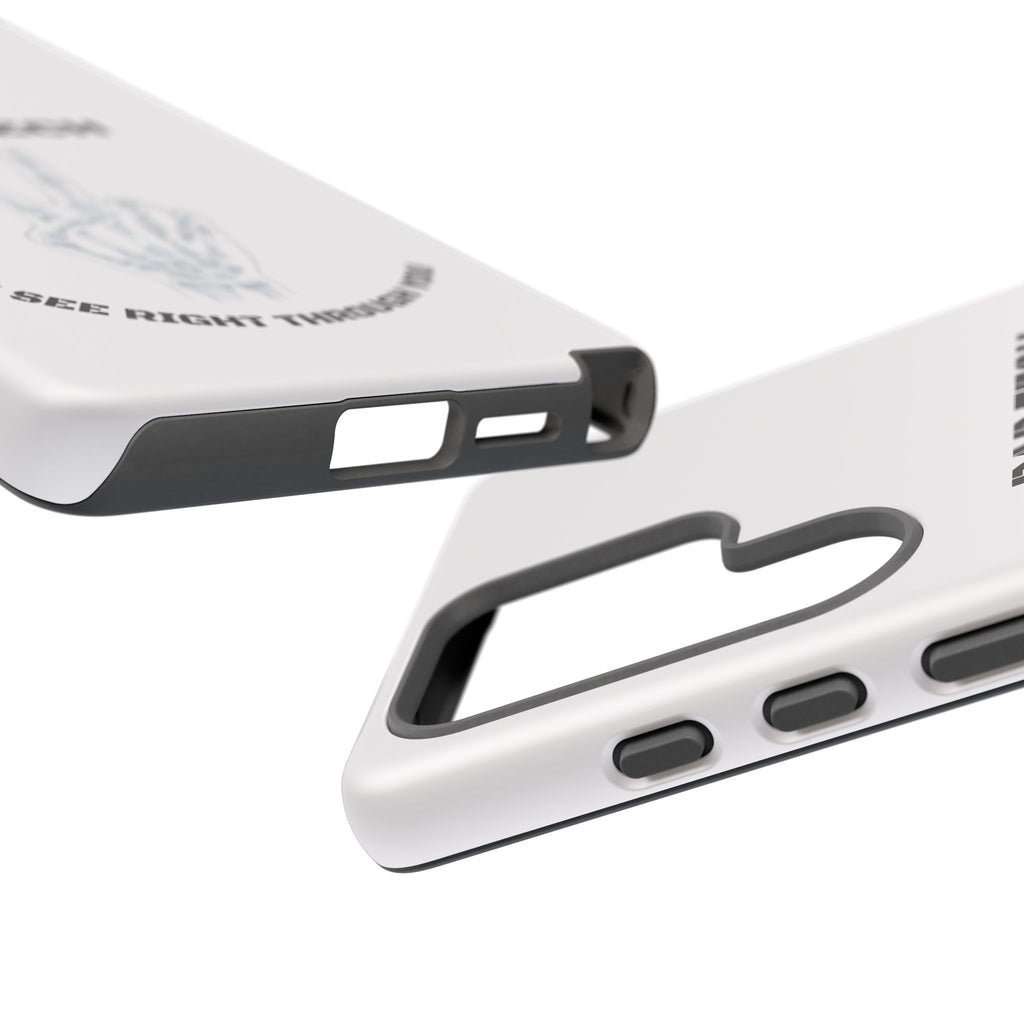 Rad Tech Phone Case — Skeleton Hand "I See Right Through You" X-ray Technician Gift