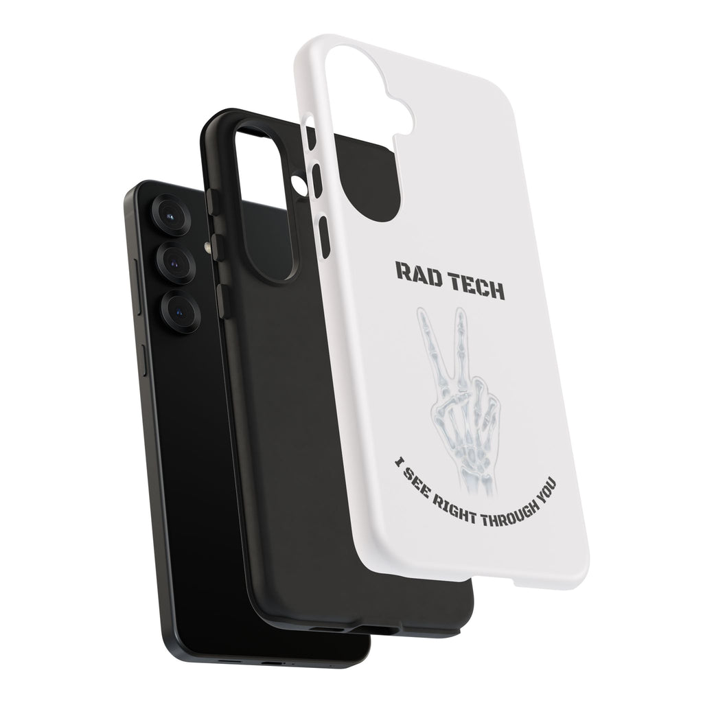 Rad Tech Phone Case — Skeleton Hand "I See Right Through You" X-ray Technician Gift