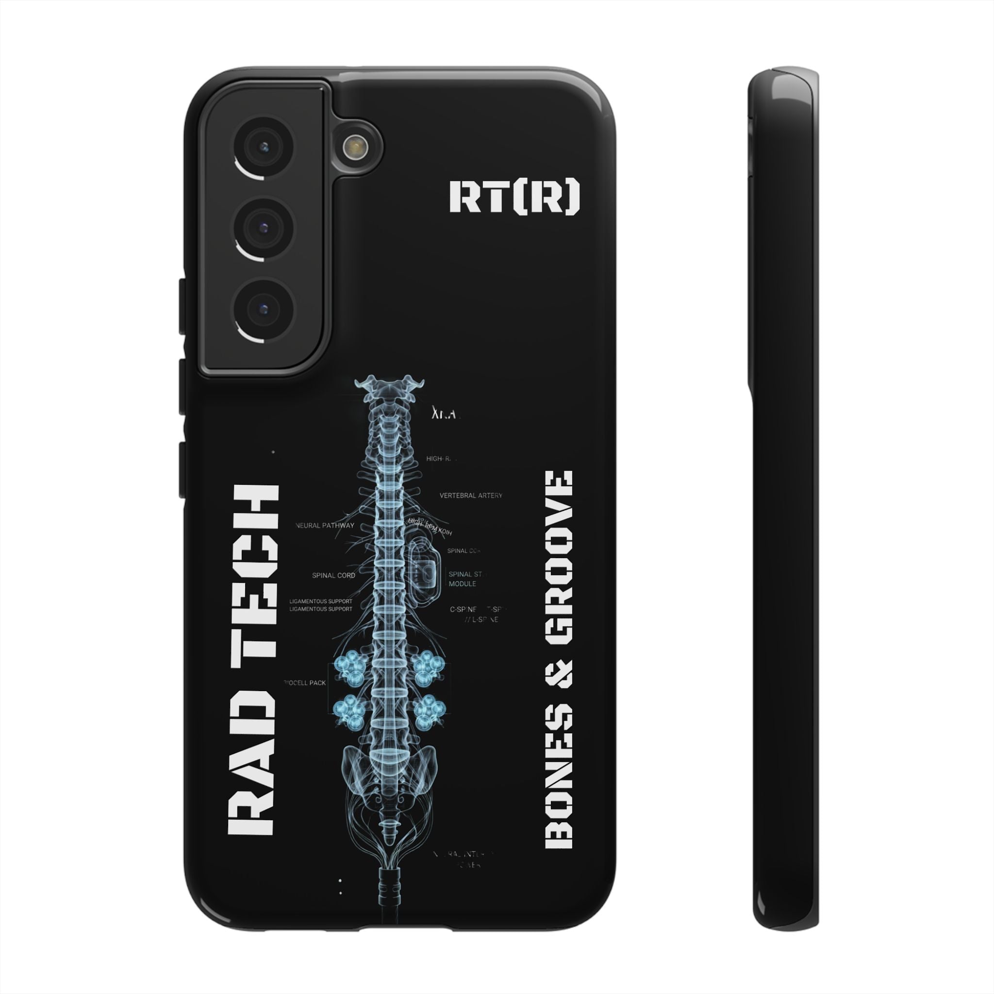RAD TECH -Aesthetic Phone Case