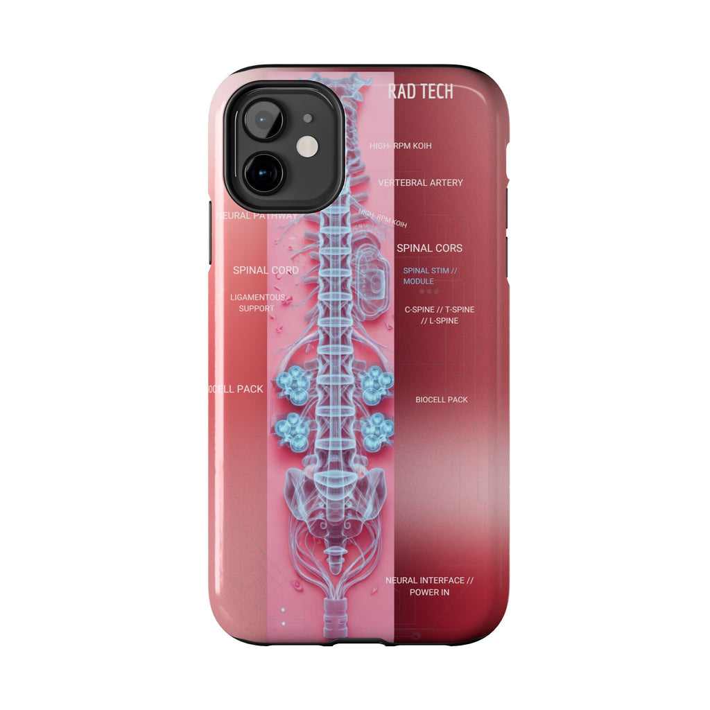 Anatomical Spine Tough Phone Case — Medical X-Ray Design, ‘Spinal Cord’ Labelled