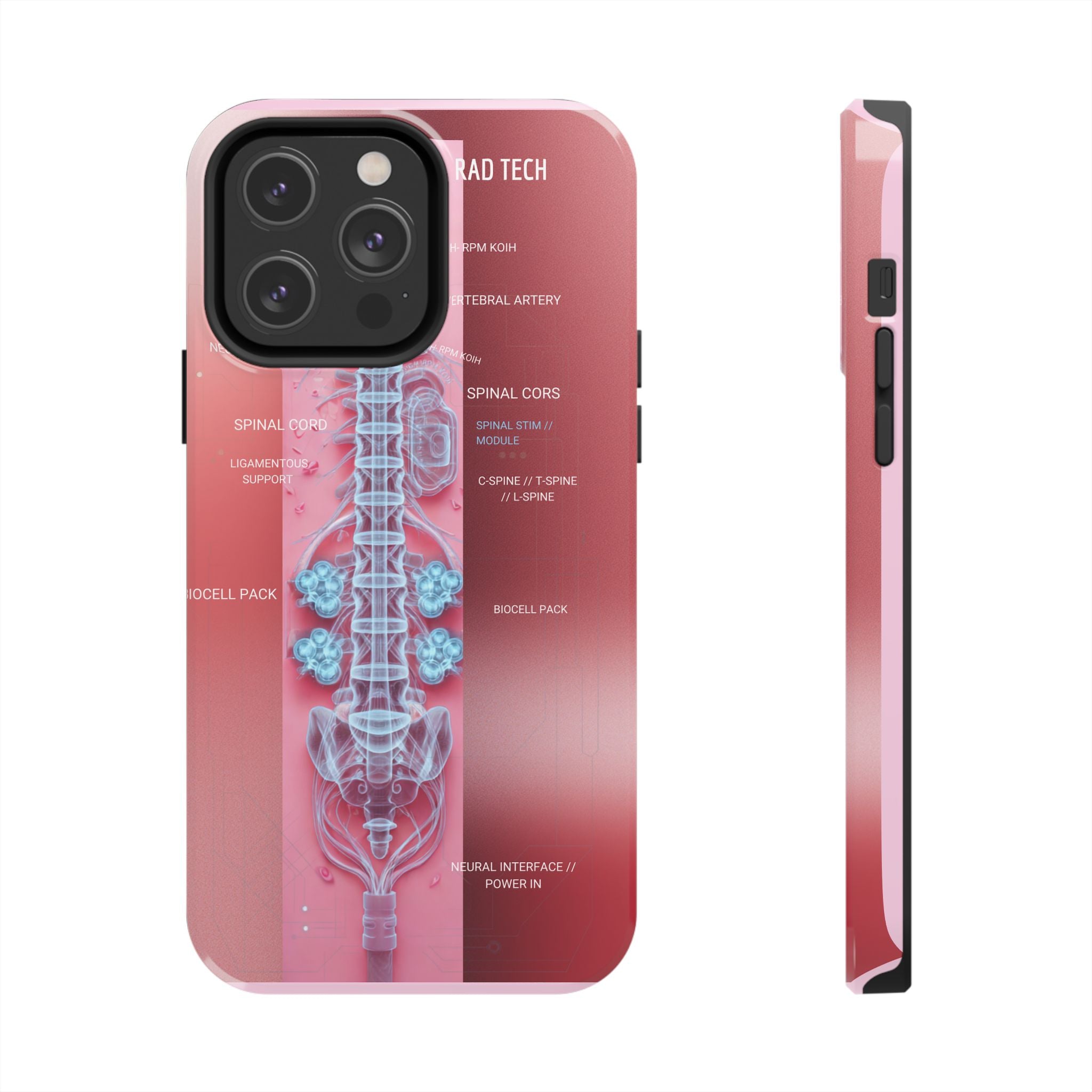 Anatomical Spine Tough Phone Case — Medical X-Ray Design, ‘Spinal Cord’ Labelled