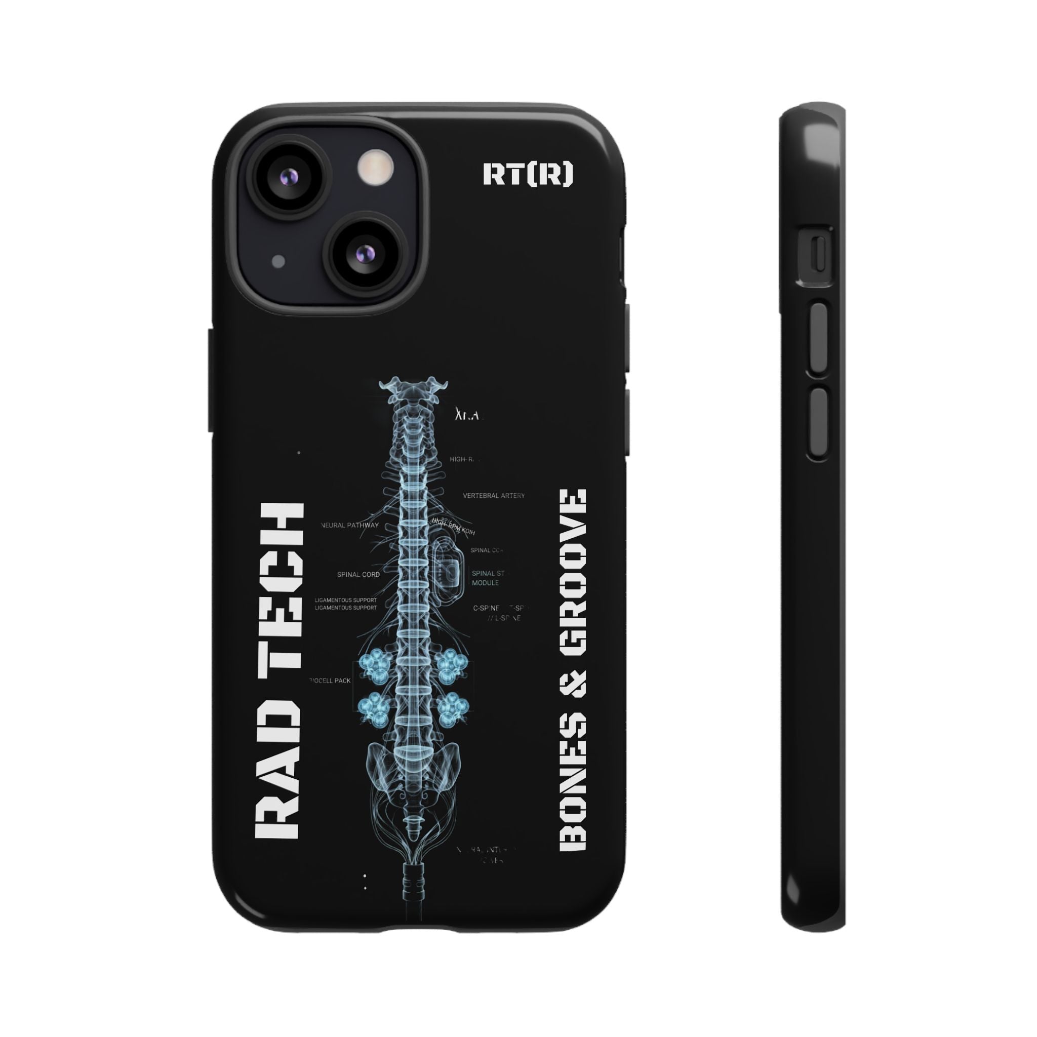 RAD TECH -Aesthetic Phone Case