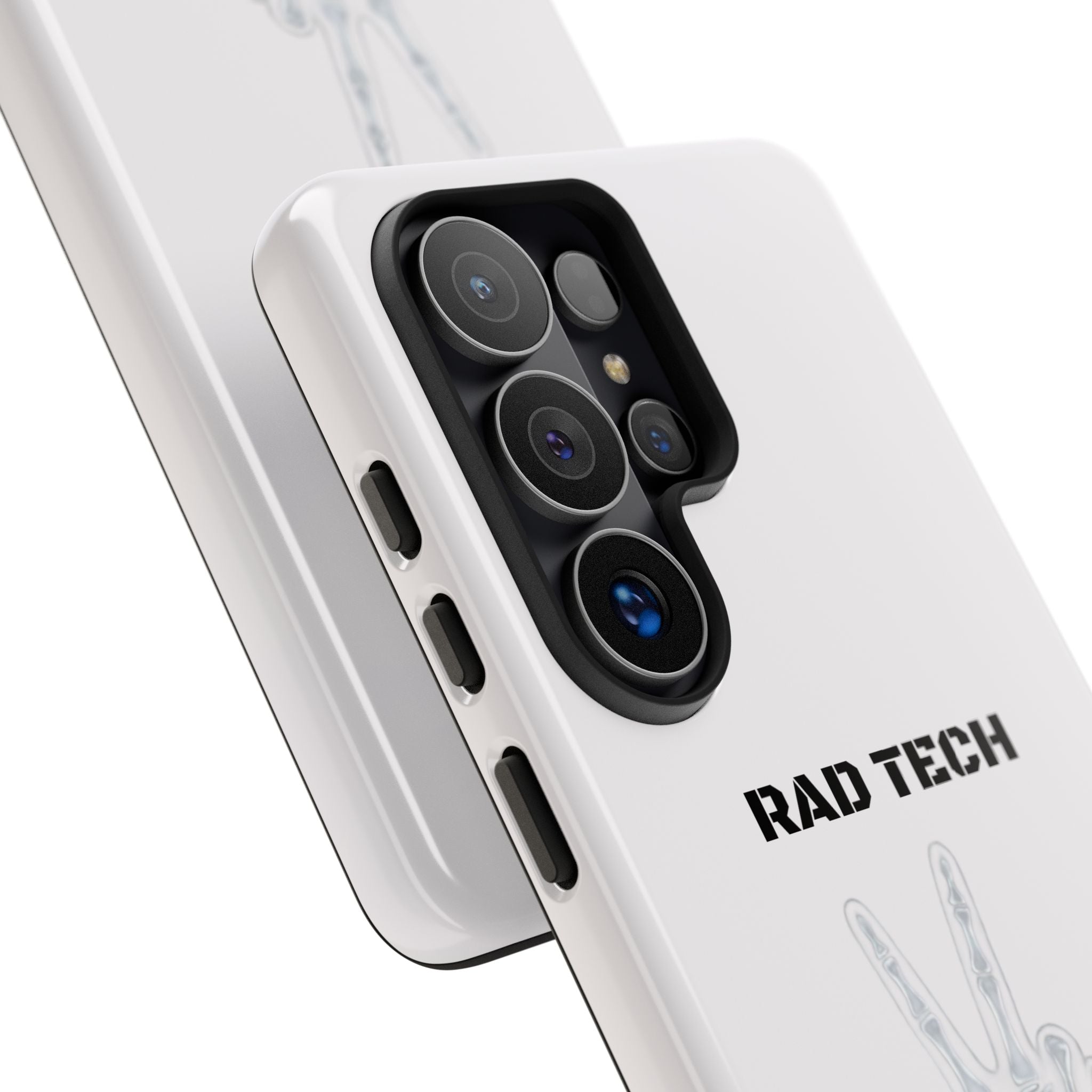Rad Tech Phone Case — Skeleton Hand "I See Right Through You" X-ray Technician Gift