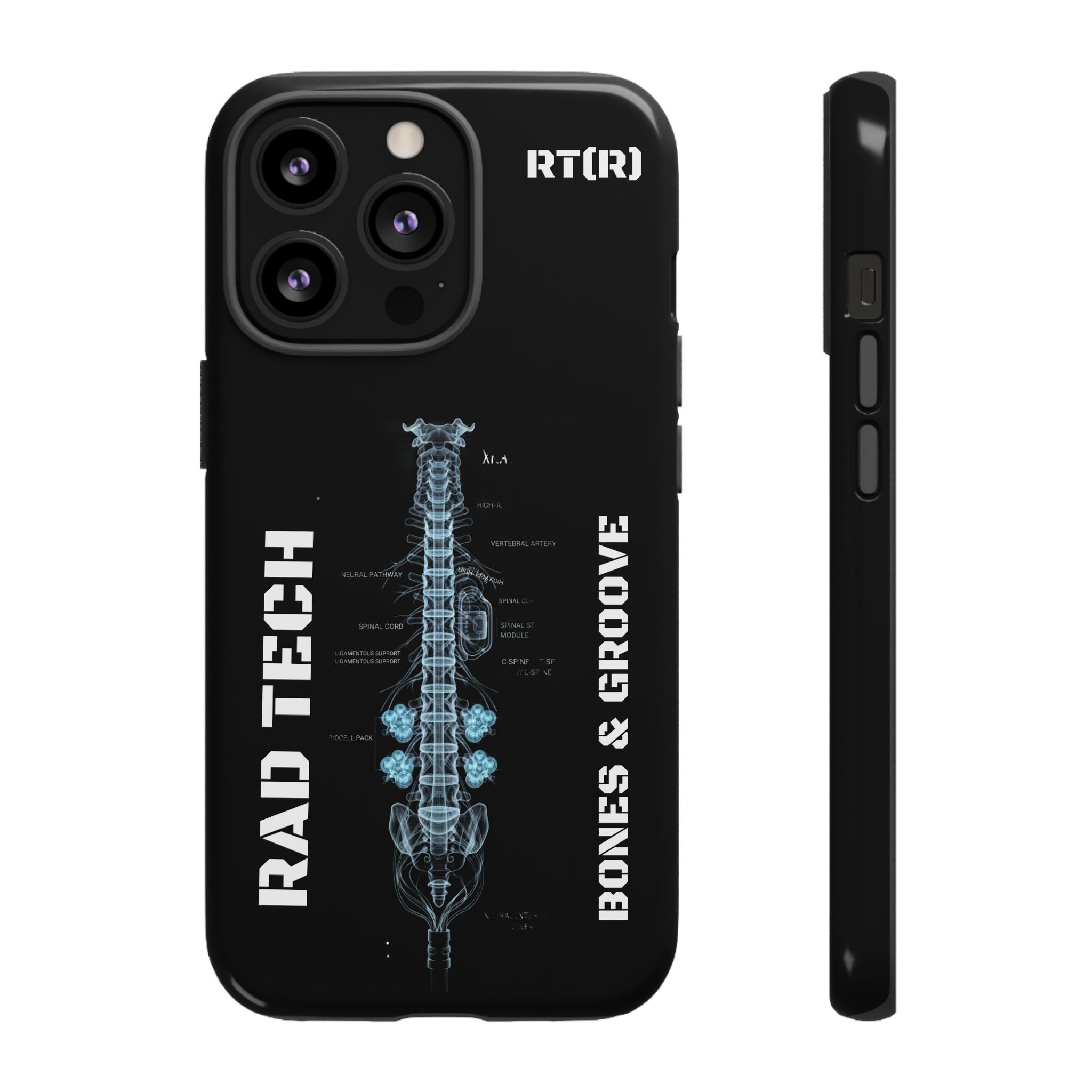 RAD TECH -Aesthetic Phone Case