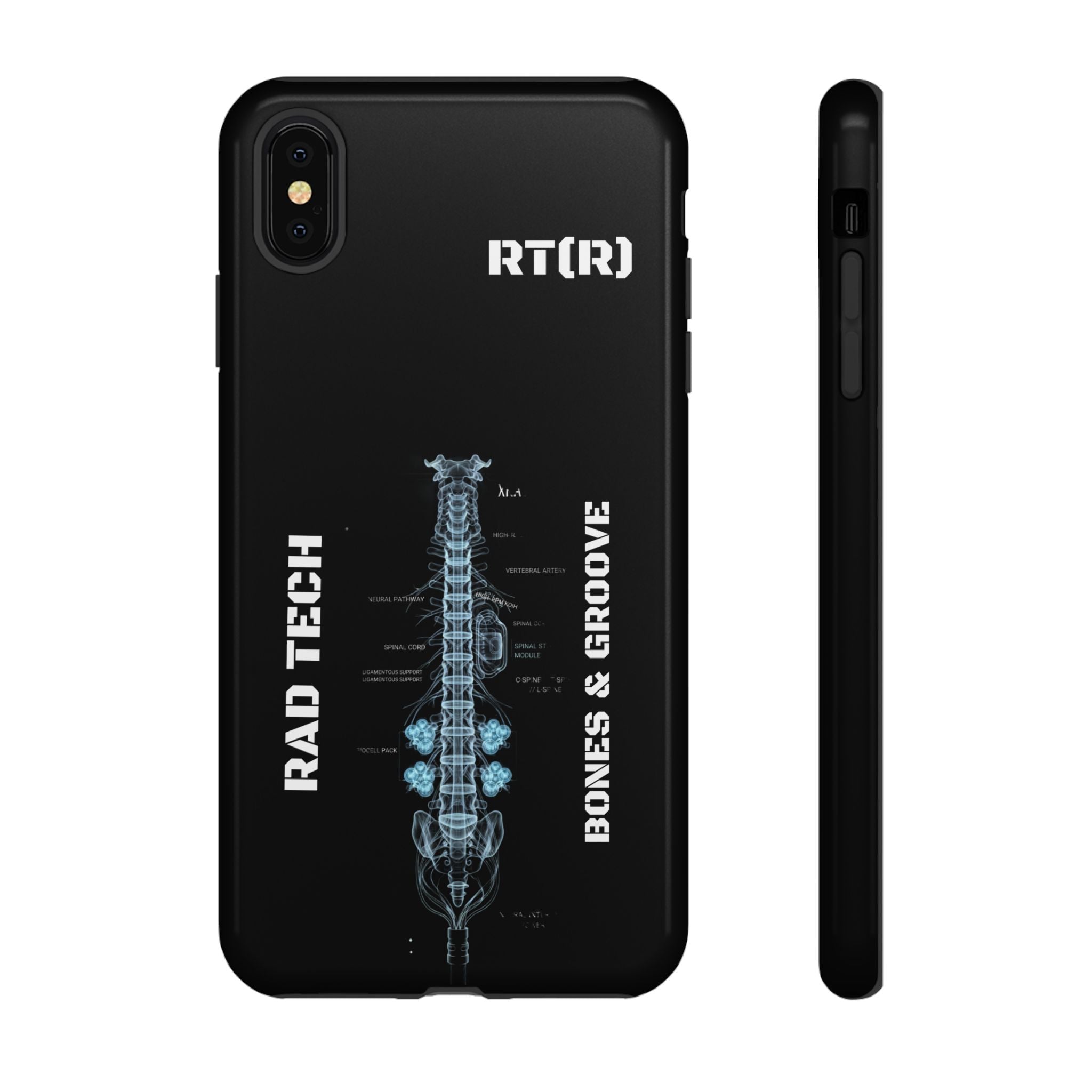 RAD TECH -Aesthetic Phone Case